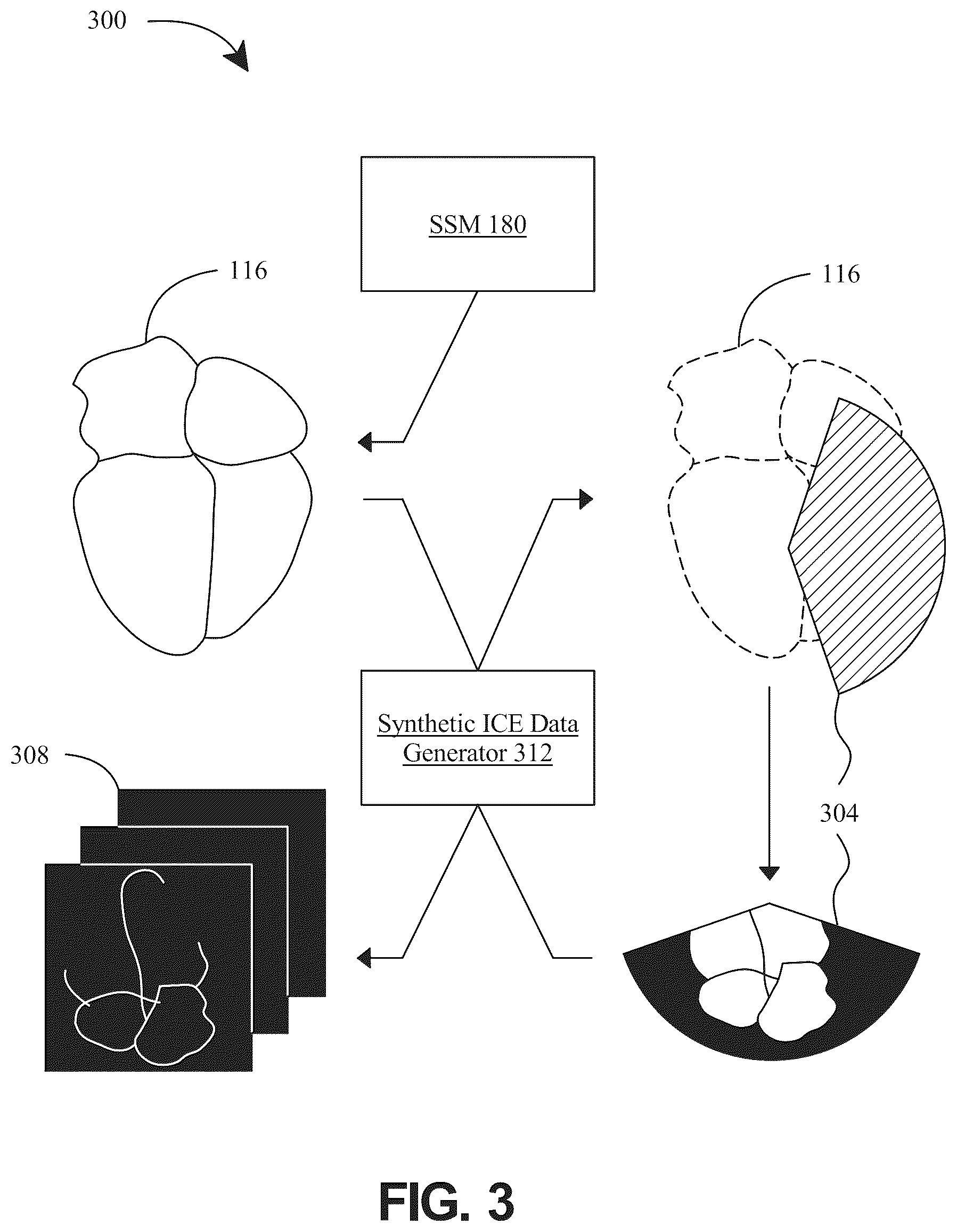 Patent US12322104 Figure 3 – Apparatus and methods for generating a three-dimensional (3D) model of cardiac anatomy via machine-learning