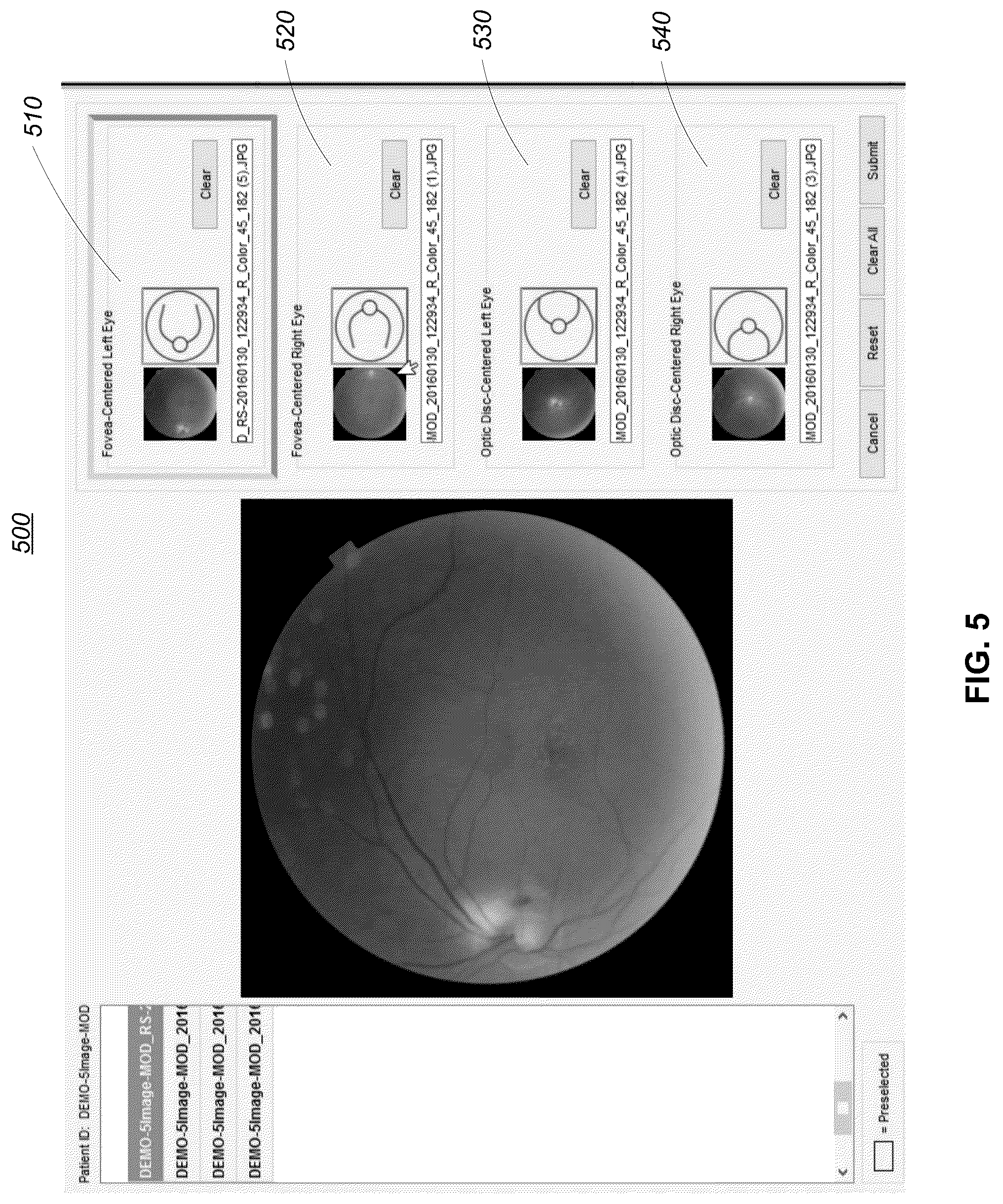 Patent US12322106 Figure 5 – Image retention and stitching for minimal-flash eye disease diagnosis