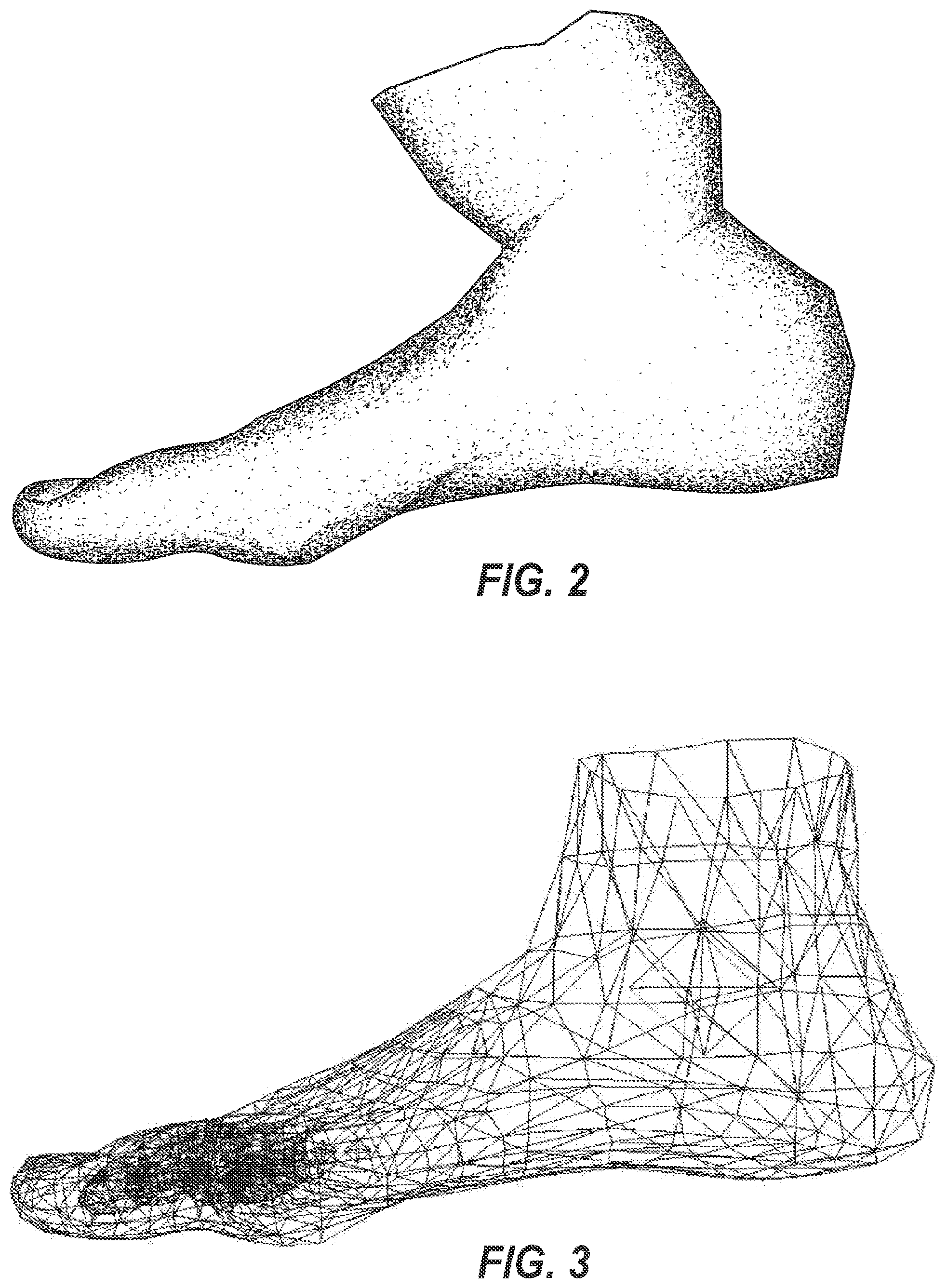 Patent US12322108 Figure 2 – Method and apparatus for volumetric data of a predetermined anatomical feature