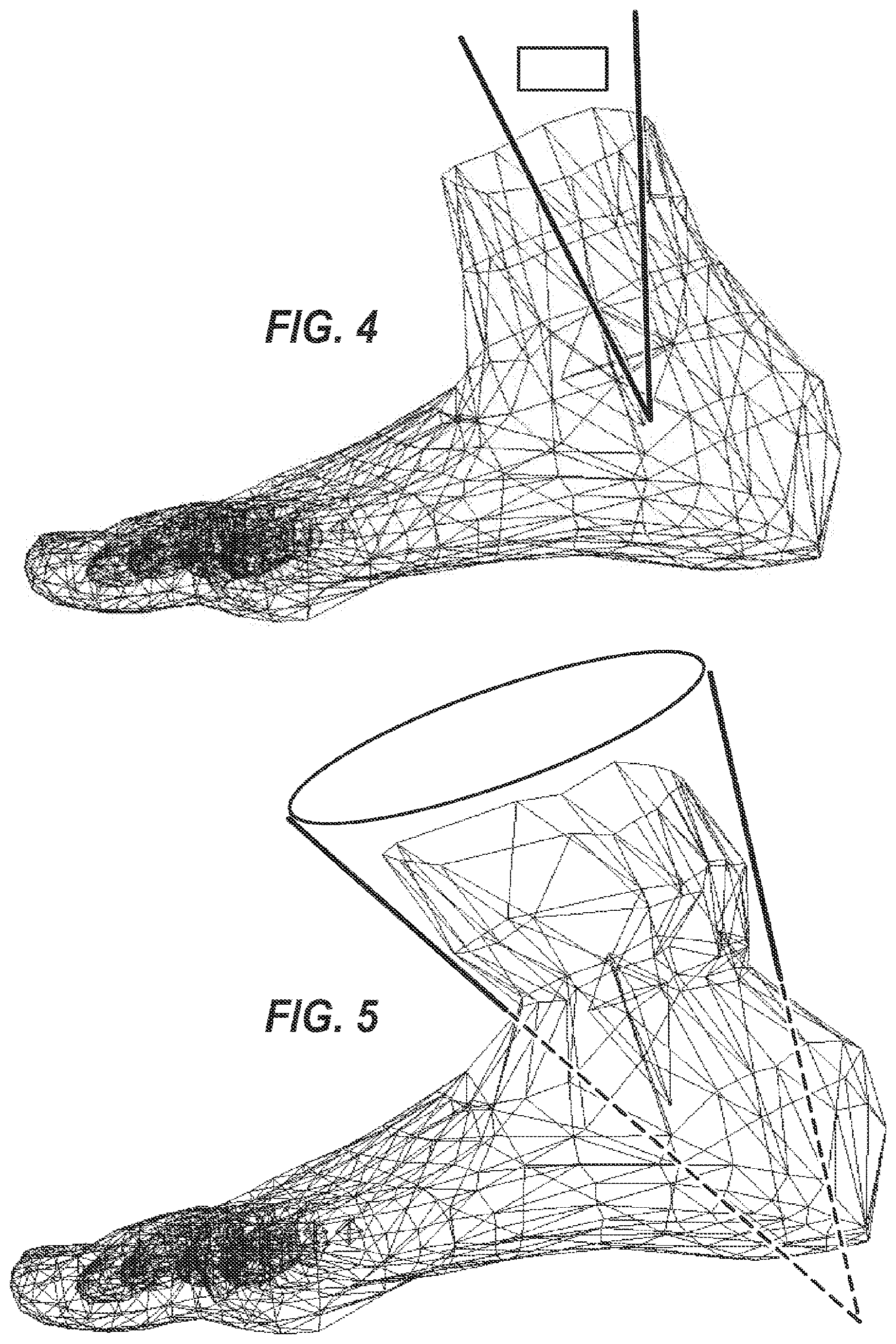 Patent US12322108 Figure 3 – Method and apparatus for volumetric data of a predetermined anatomical feature