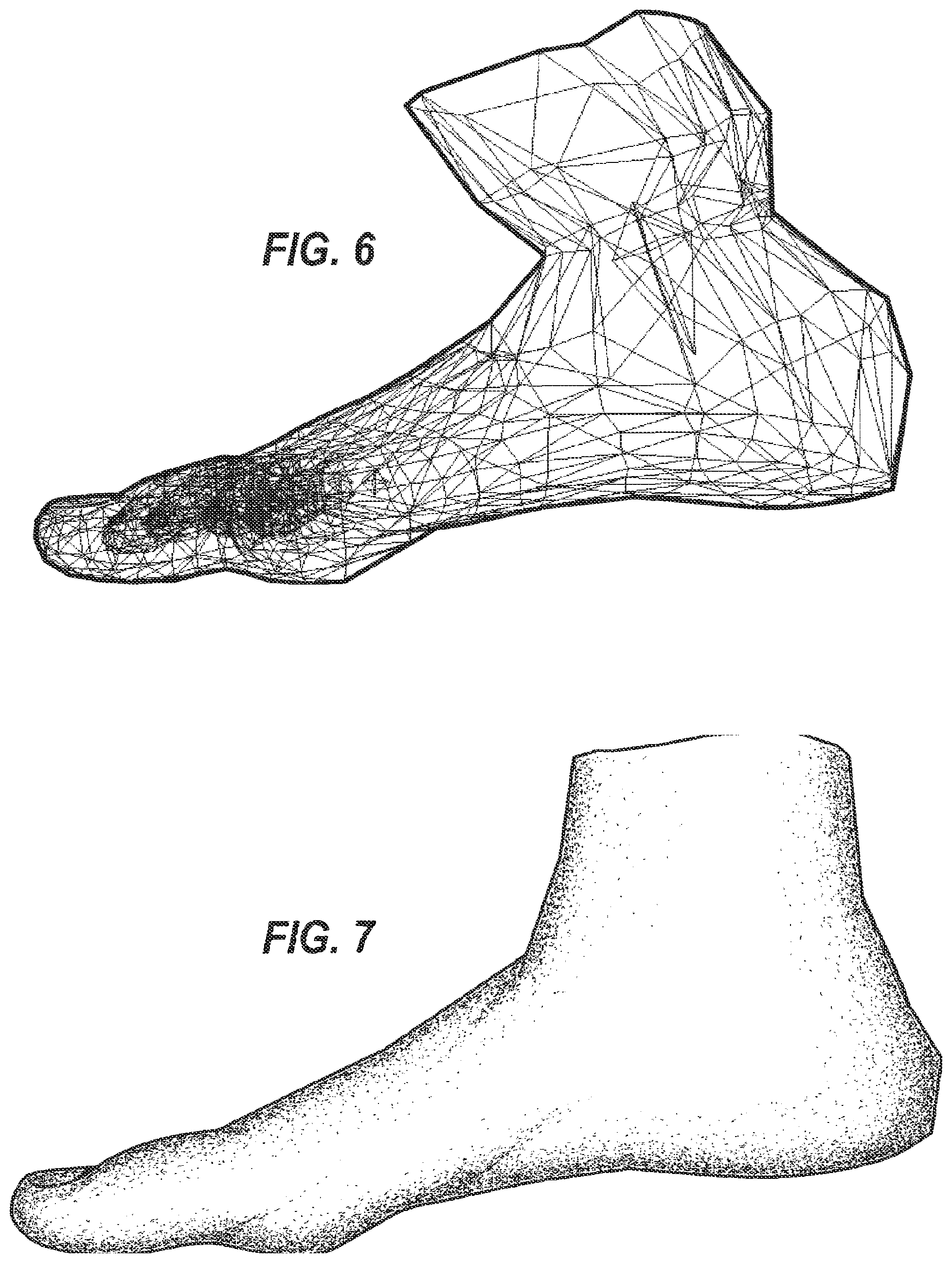 Patent US12322108 Figure 4 – Method and apparatus for volumetric data of a predetermined anatomical feature