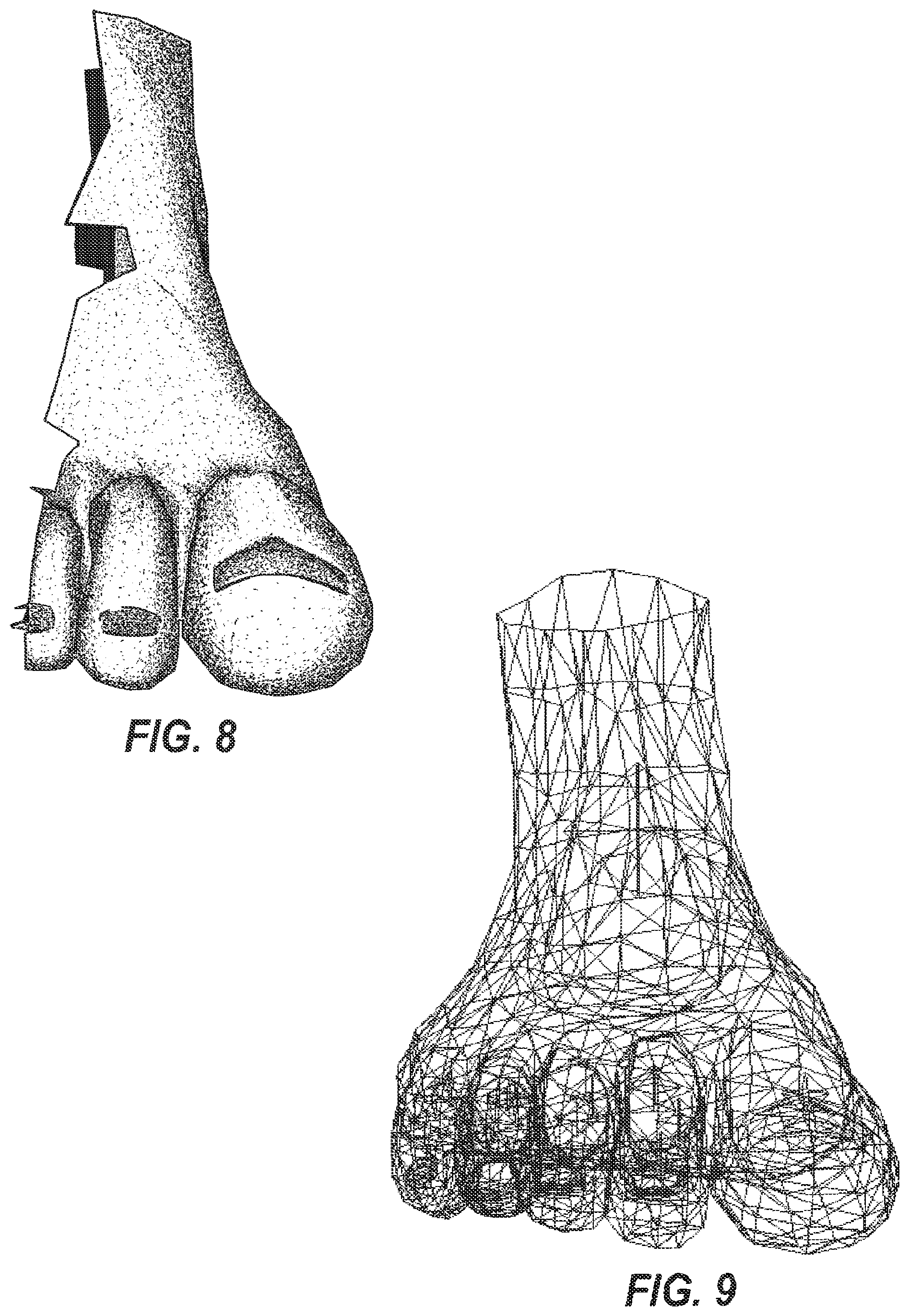 Patent US12322108 Figure 5 – Method and apparatus for volumetric data of a predetermined anatomical feature