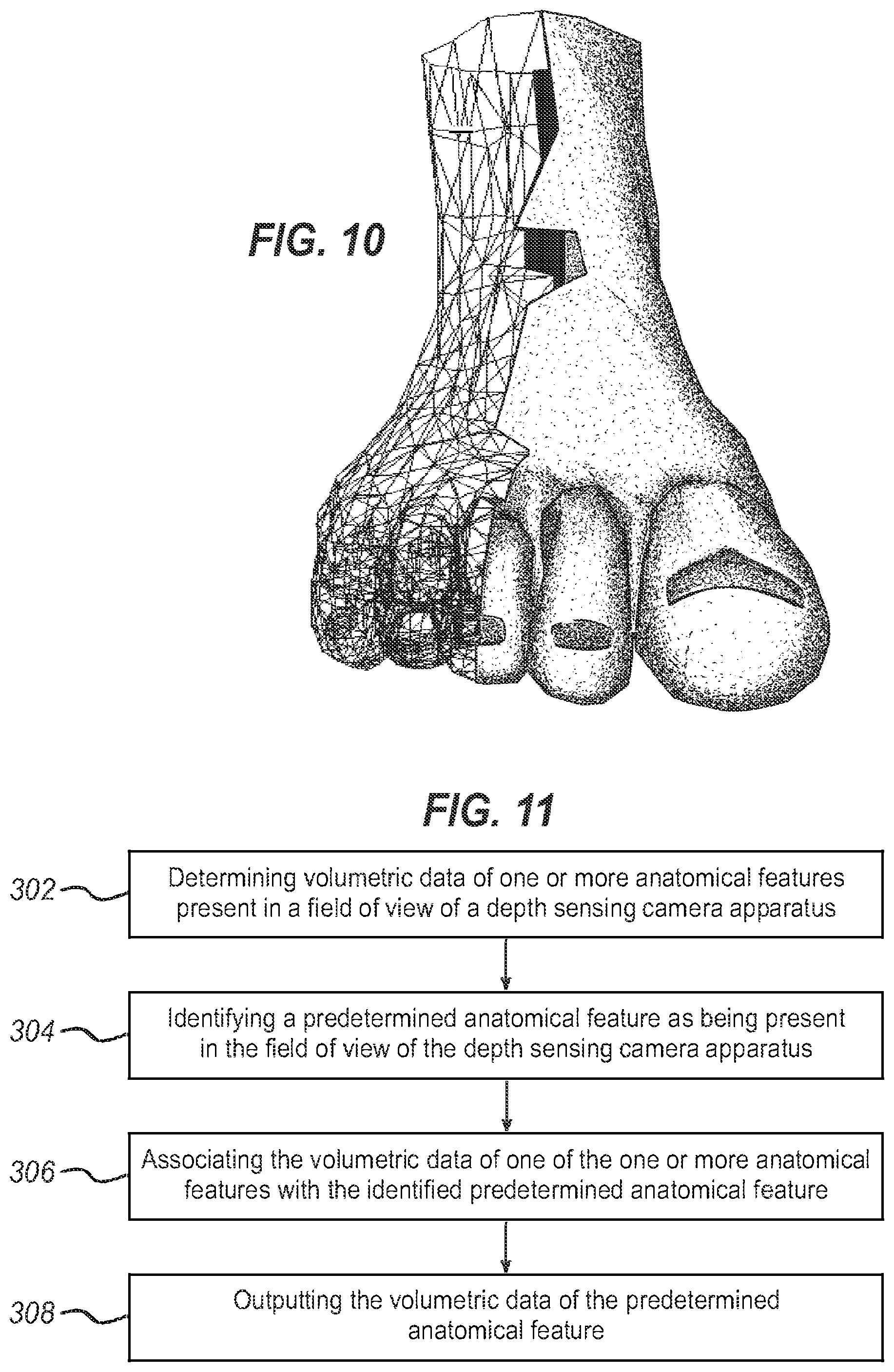 Patent US12322108 Figure 6 – Method and apparatus for volumetric data of a predetermined anatomical feature