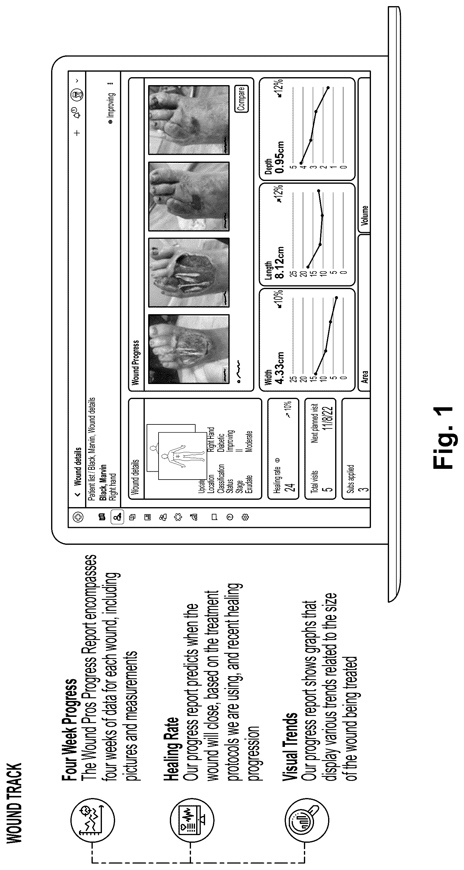 Patent US12322109 — Methods and systems for improving wound healing — Figure 1