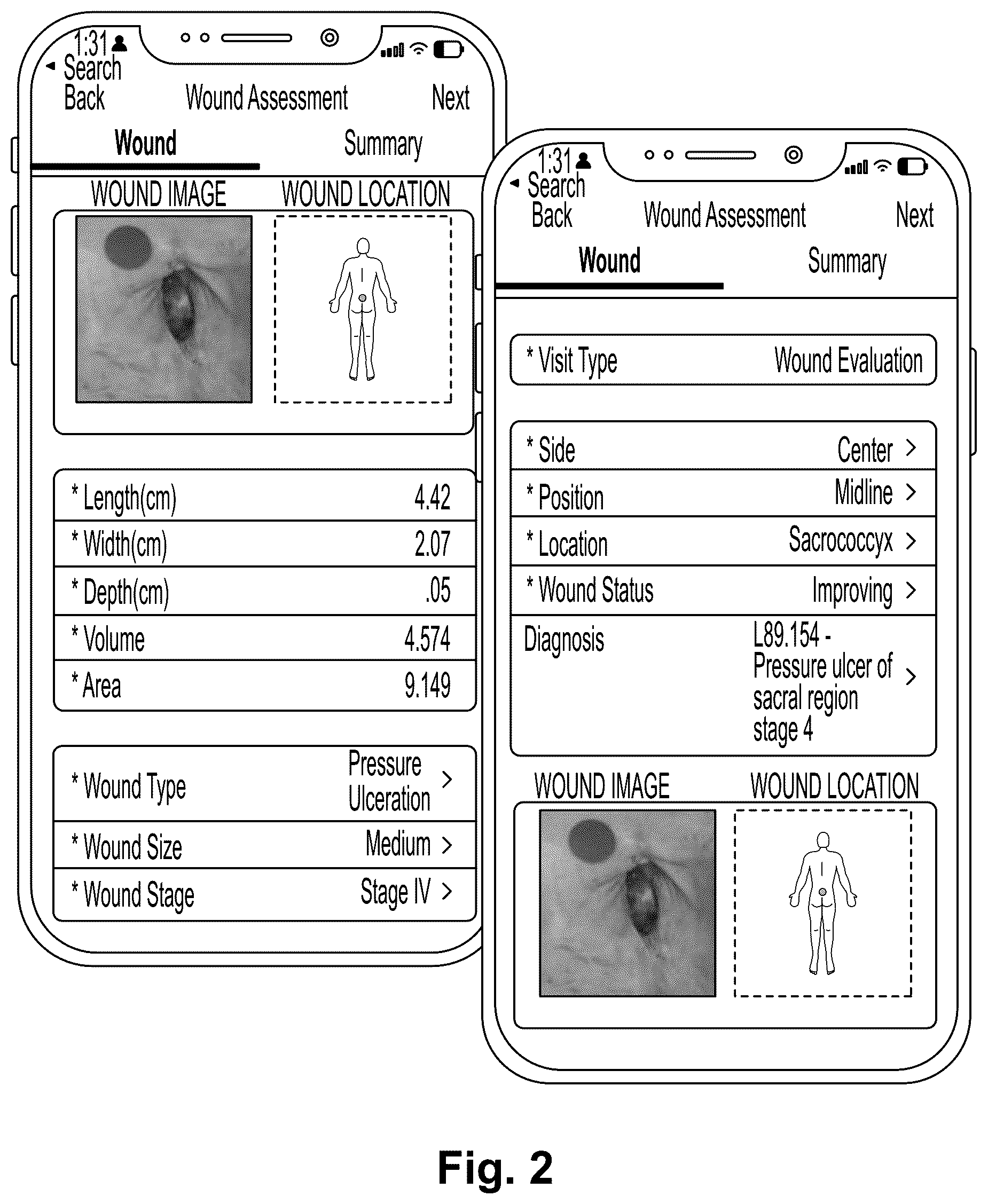 Patent US12322109 Figure 2 – Methods and systems for improving wound healing