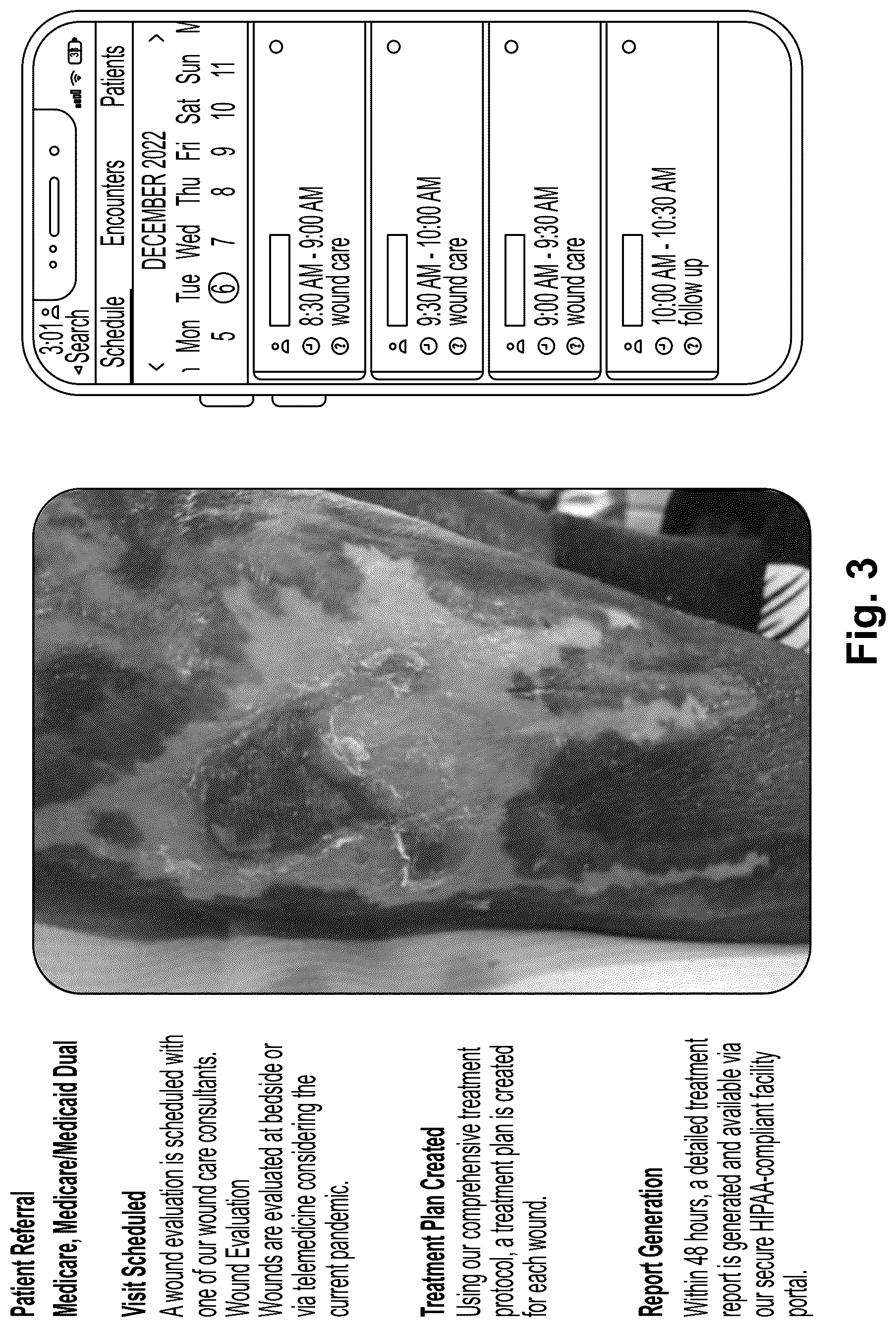 Patent US12322109 Figure 3 – Methods and systems for improving wound healing