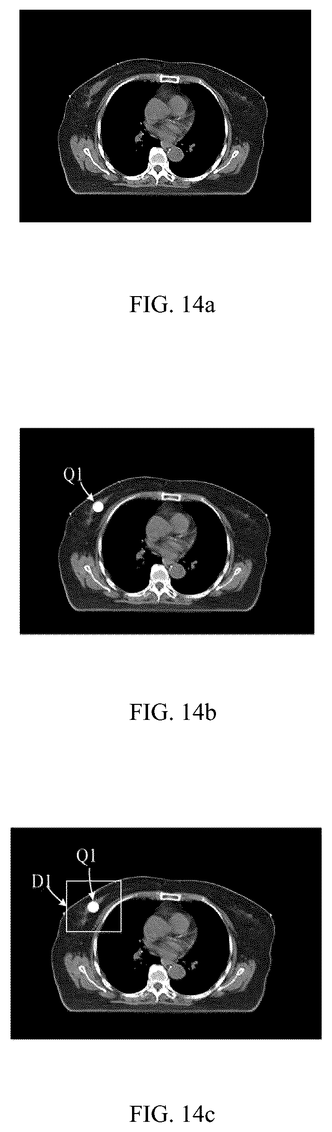 Patent US12322111 Figure 10 – Image segmentation method, device, equipment and storage medium