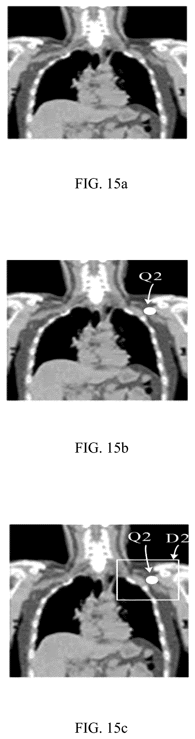 Patent US12322111 Figure 11 – Image segmentation method, device, equipment and storage medium