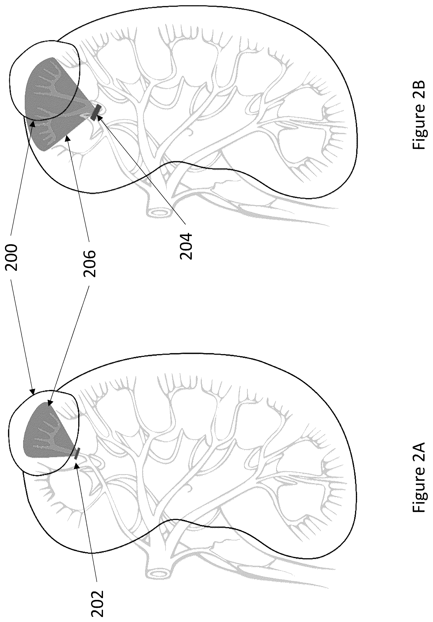 Patent US12322118 Figure 2 – Robotic surgery