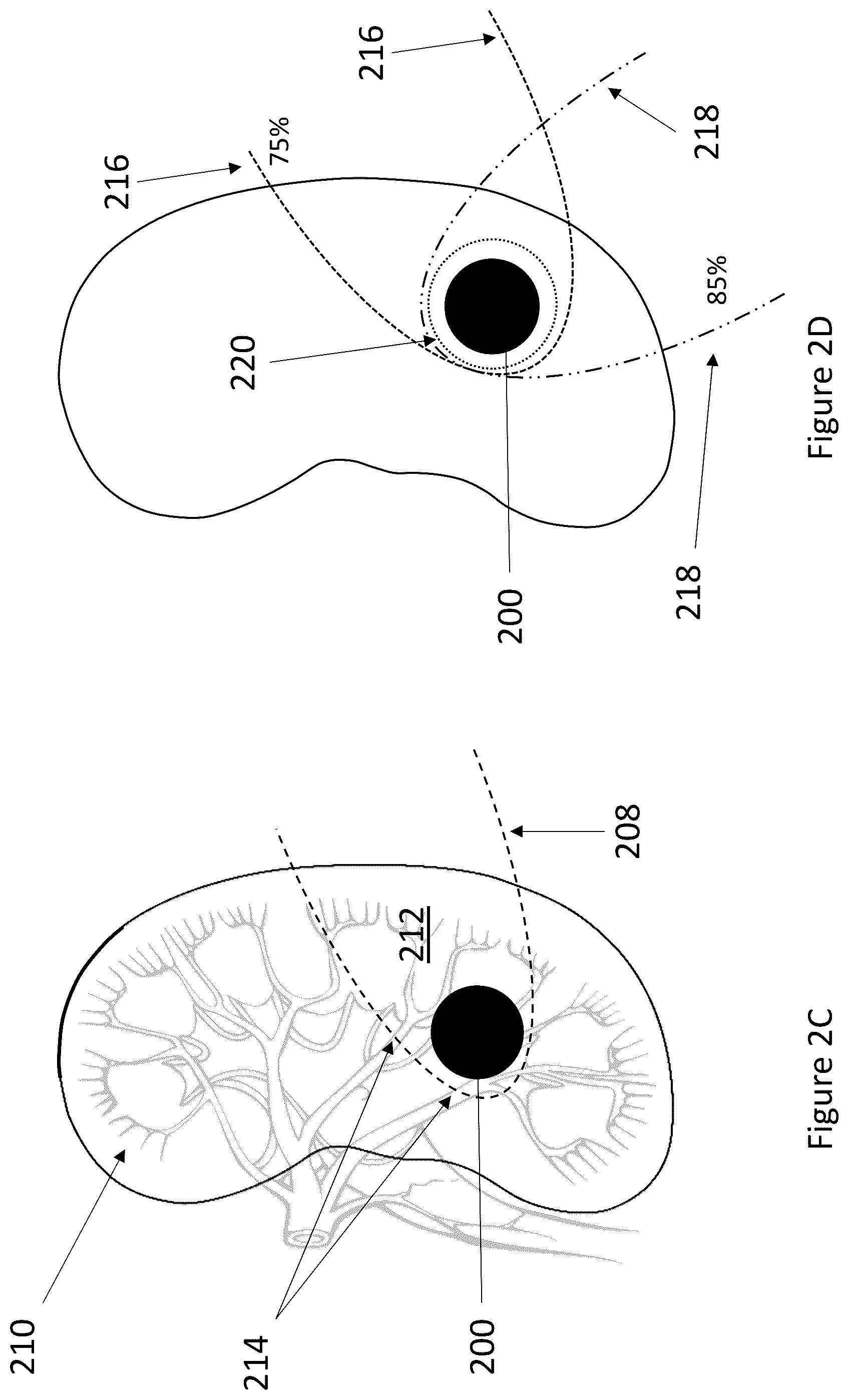 Patent US12322118 Figure 3 – Robotic surgery