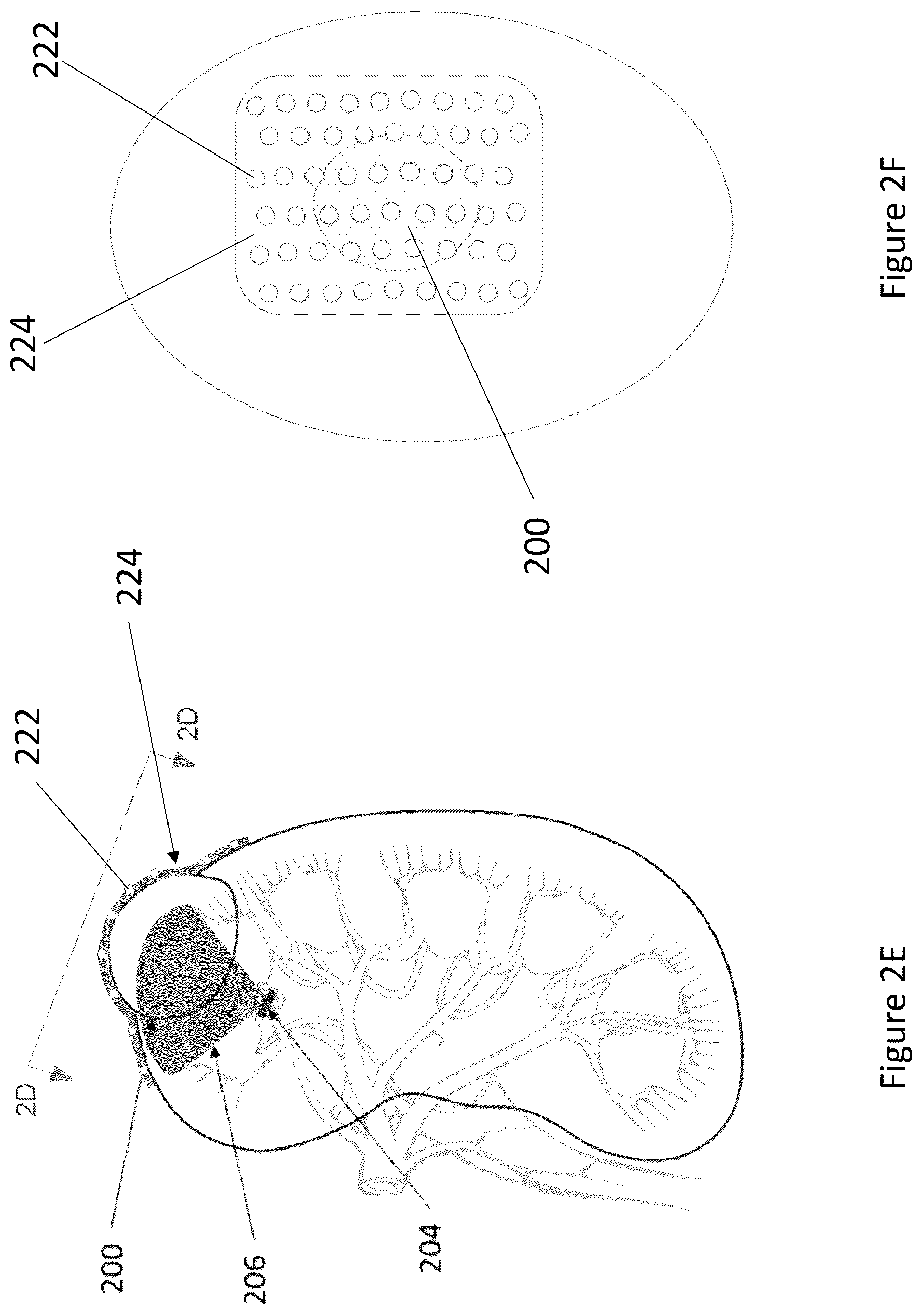 Patent US12322118 Figure 4 – Robotic surgery