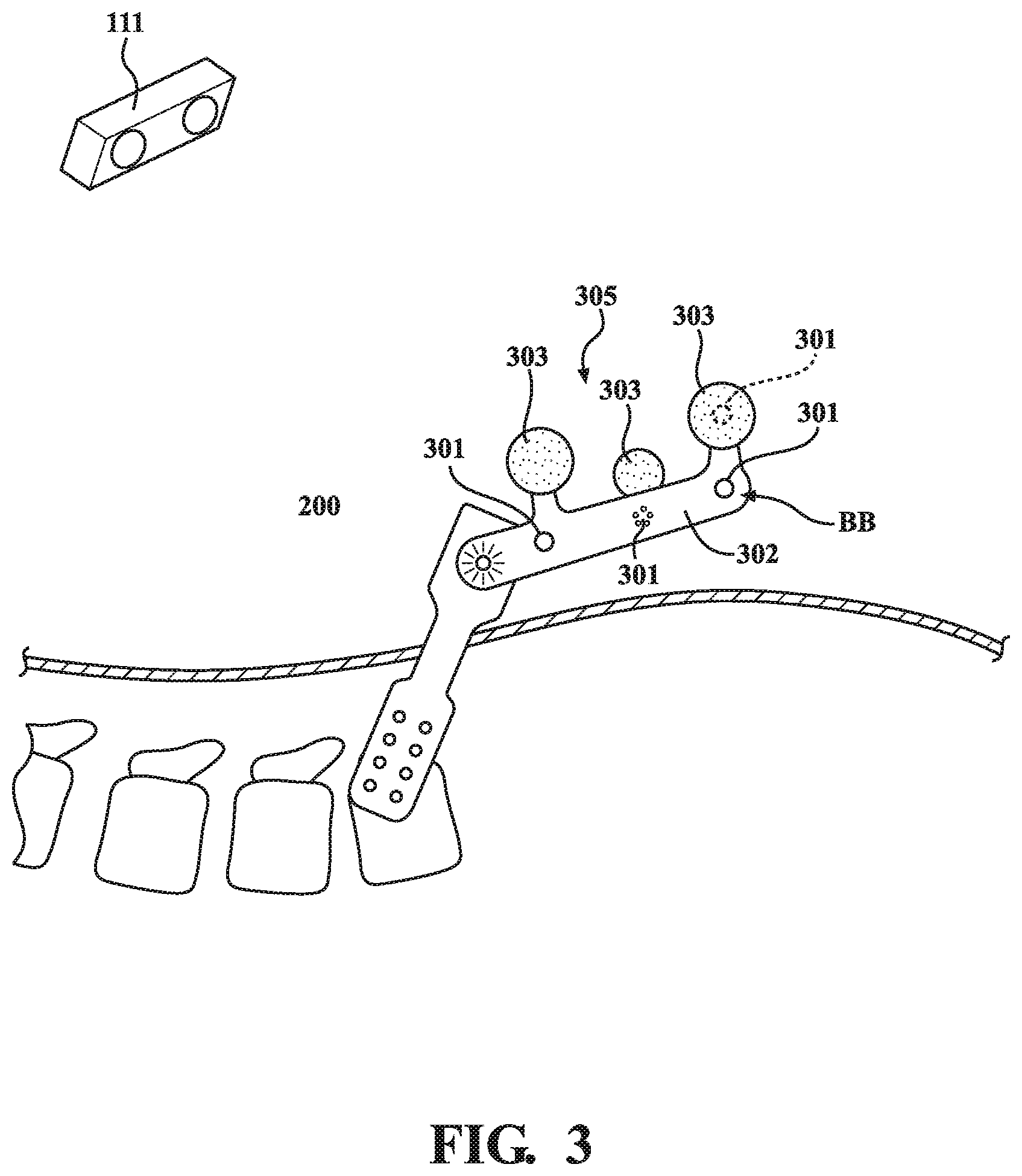 Patent US12322124 Figure 3 – Methods and systems for performing image registration in a computer-assisted surgery system