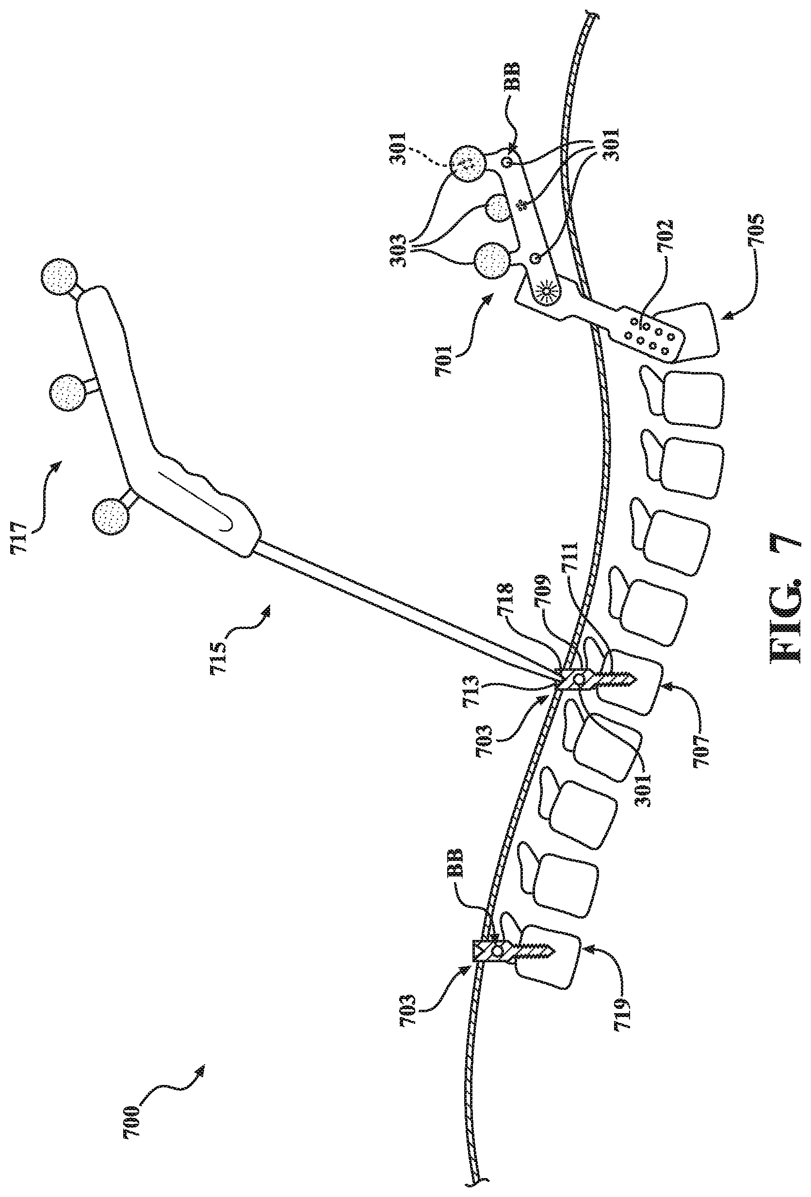 Patent US12322124 Figure 7 – Methods and systems for performing image registration in a computer-assisted surgery system
