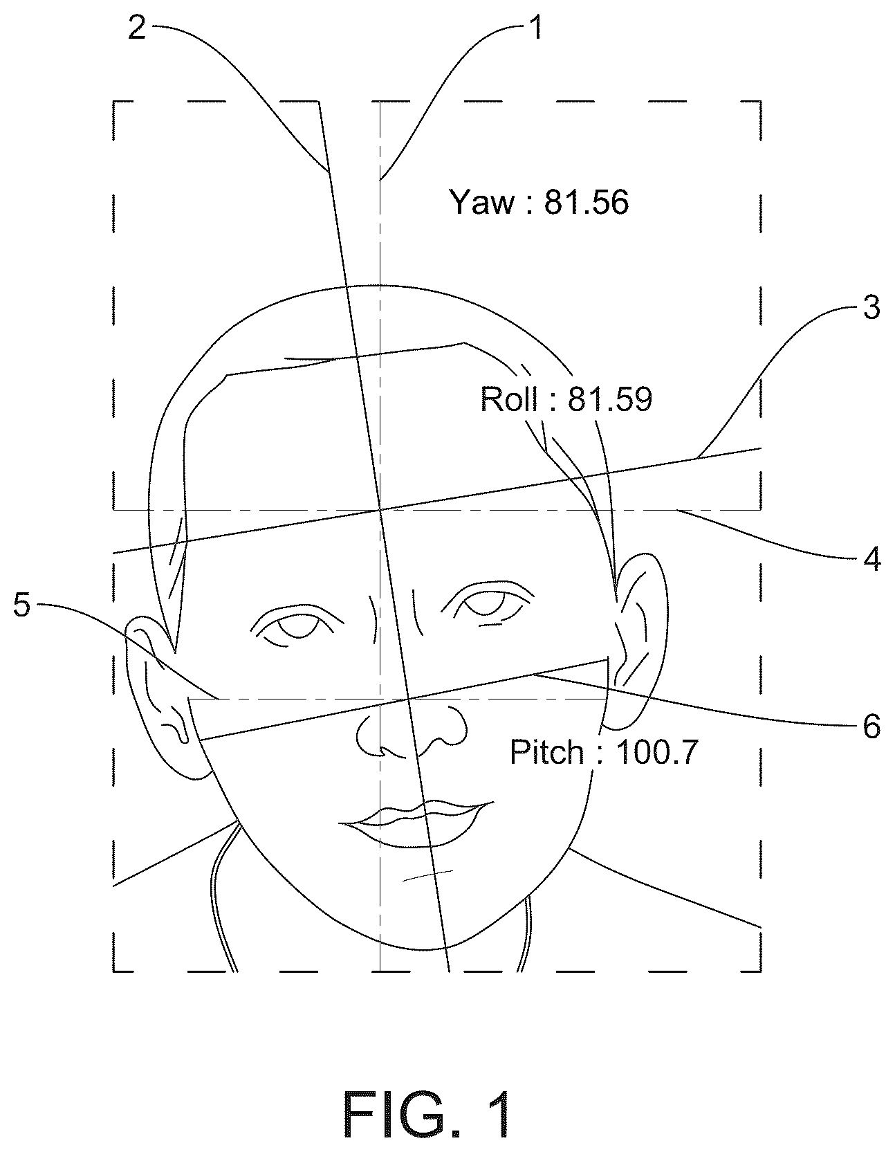Patent US12322133 Figure 1 – Devices, systems and methods for precise human head positioning
