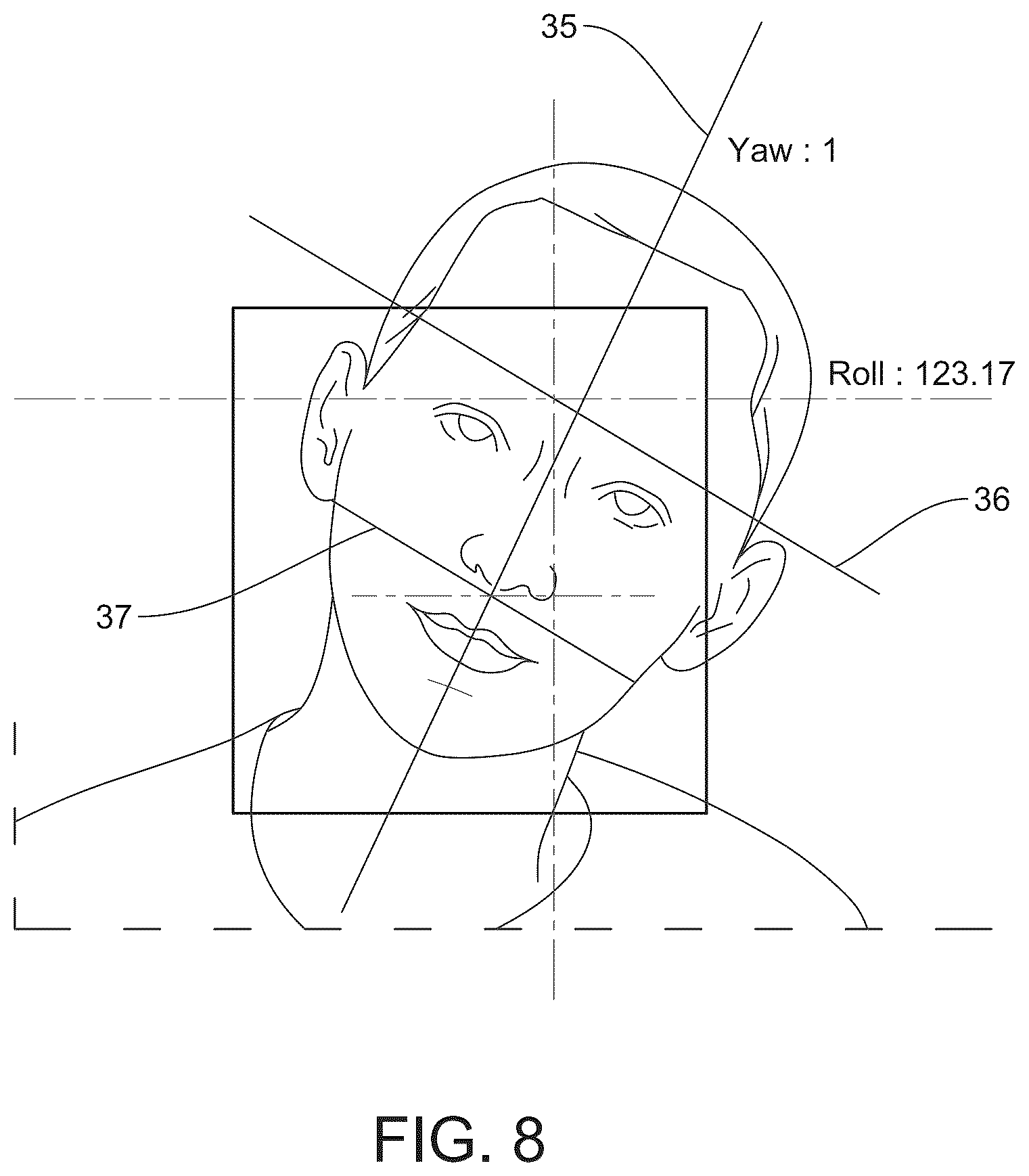 Patent US12322133 Figure 6 – Devices, systems and methods for precise human head positioning