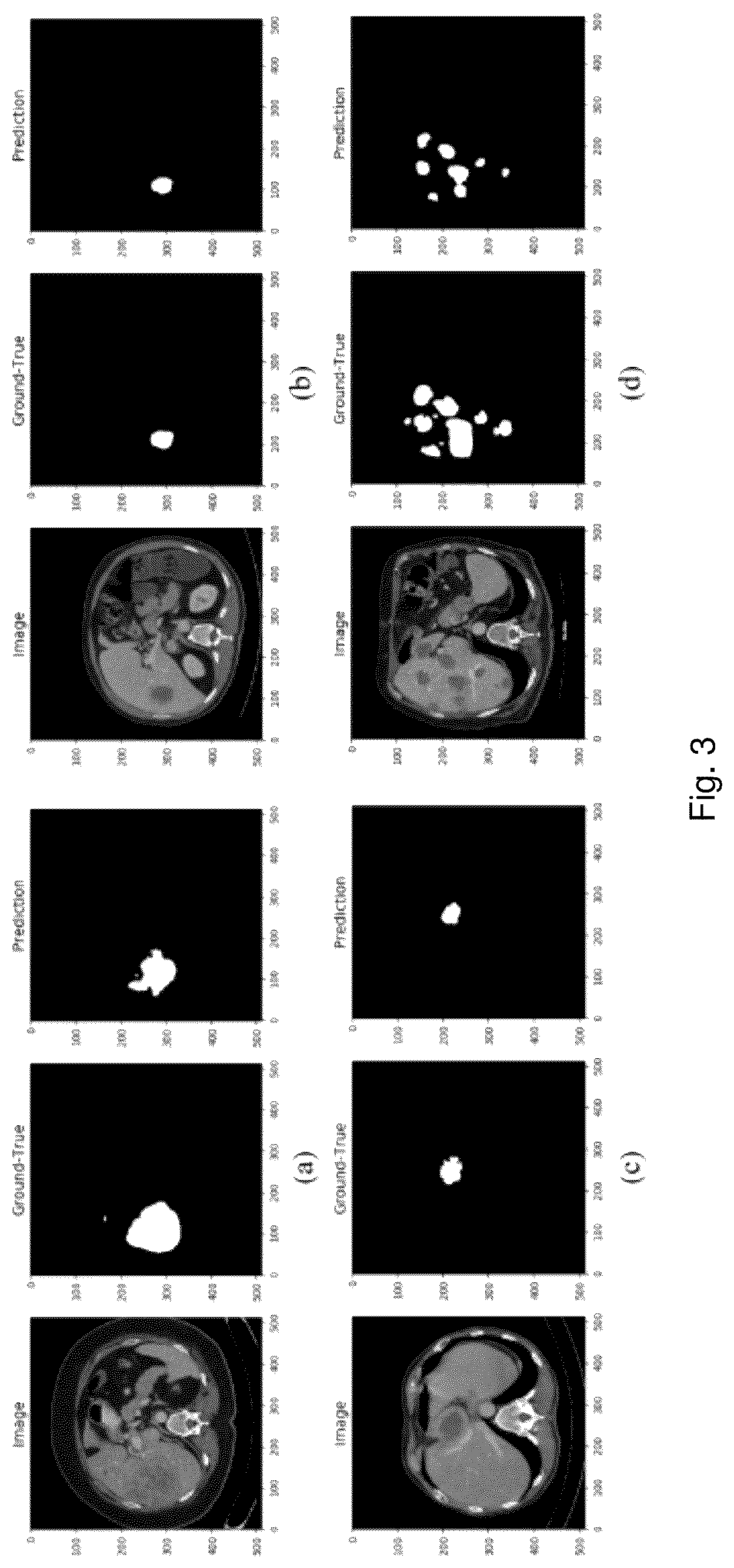 Patent US12322151 Figure 3 – DA-BD-LSTM-dense-UNet for liver lesion segmentation