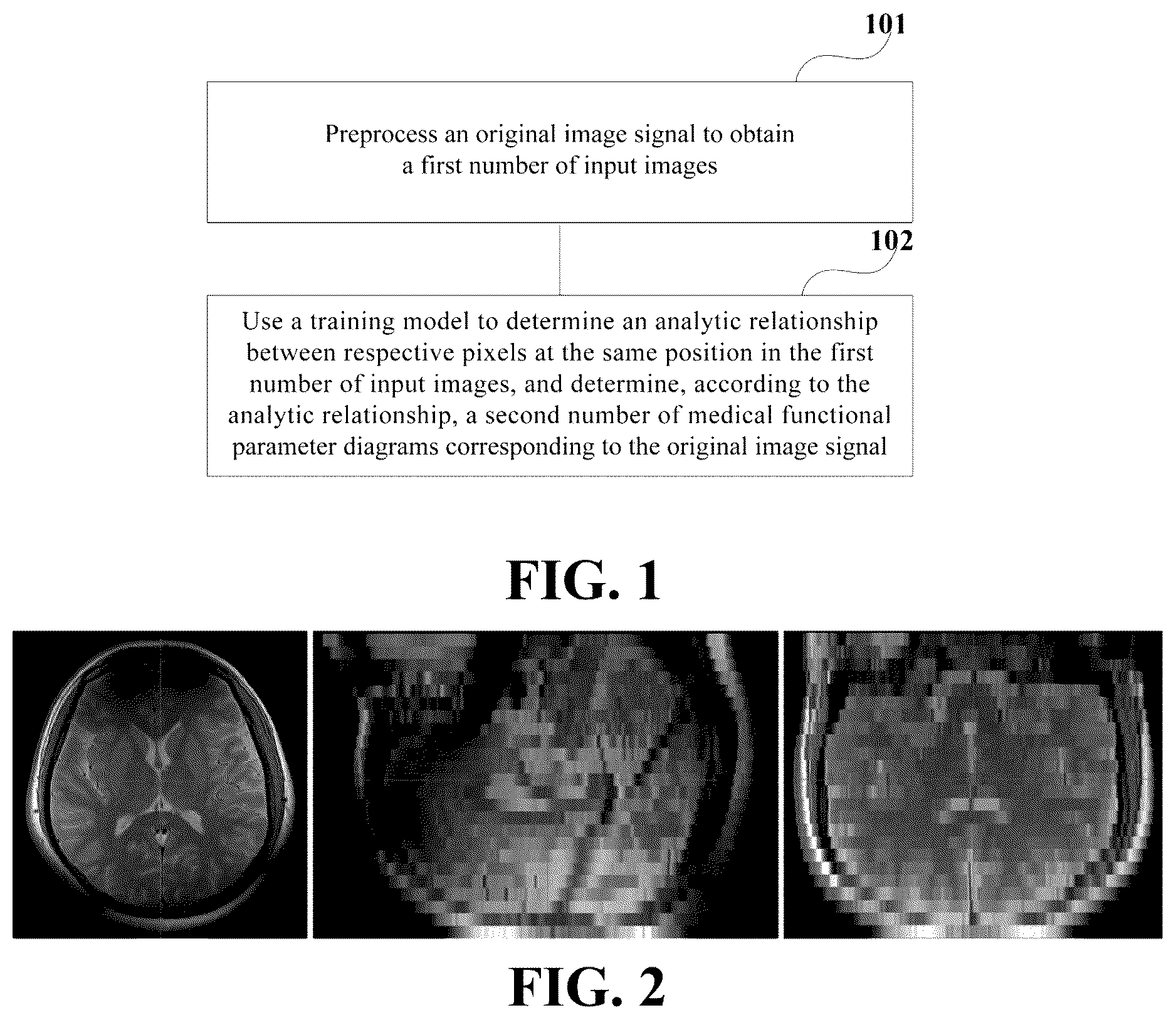 Patent US12322159 Figure 1 – Medical image acquisition apparatus and method