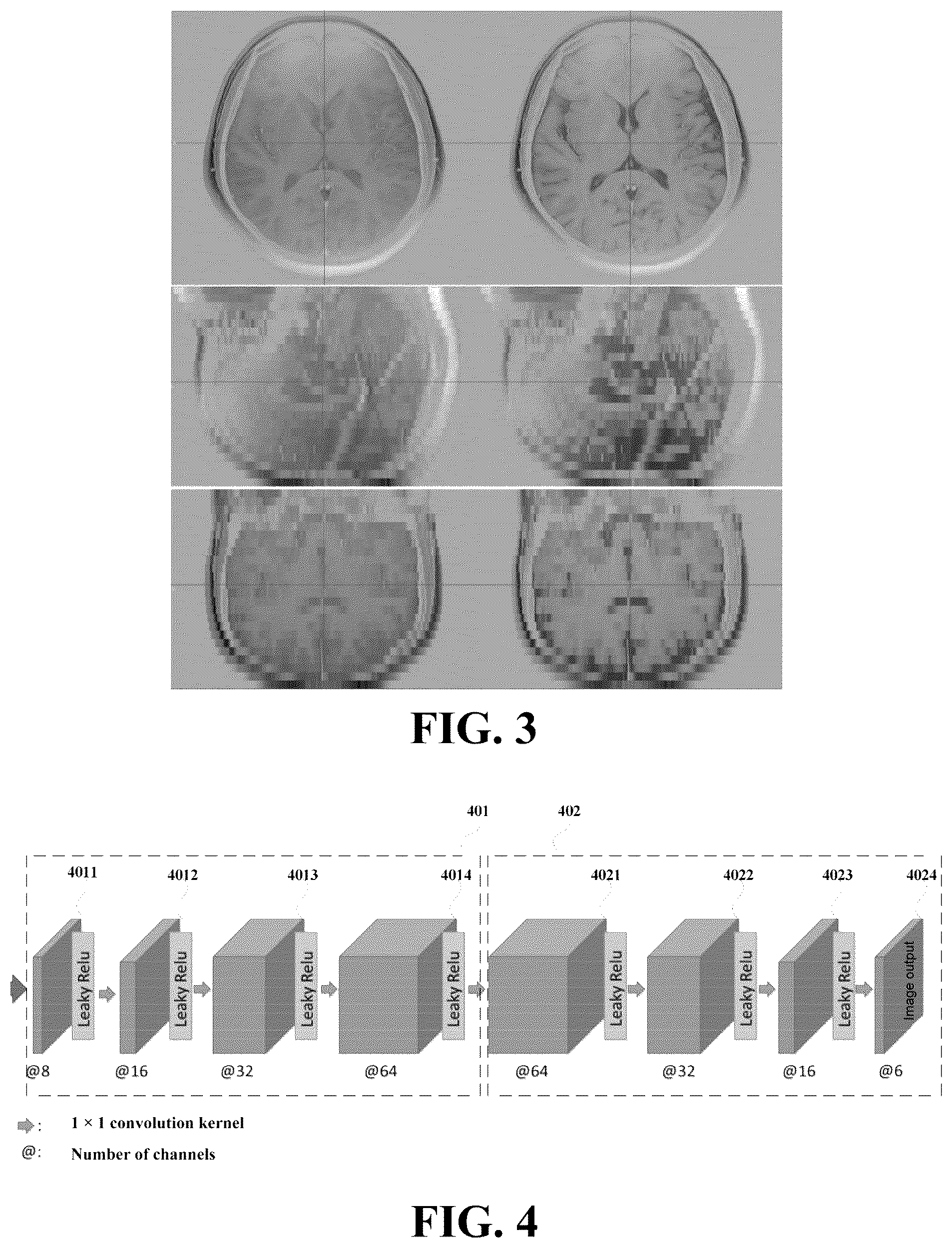 Patent US12322159 Figure 2 – Medical image acquisition apparatus and method