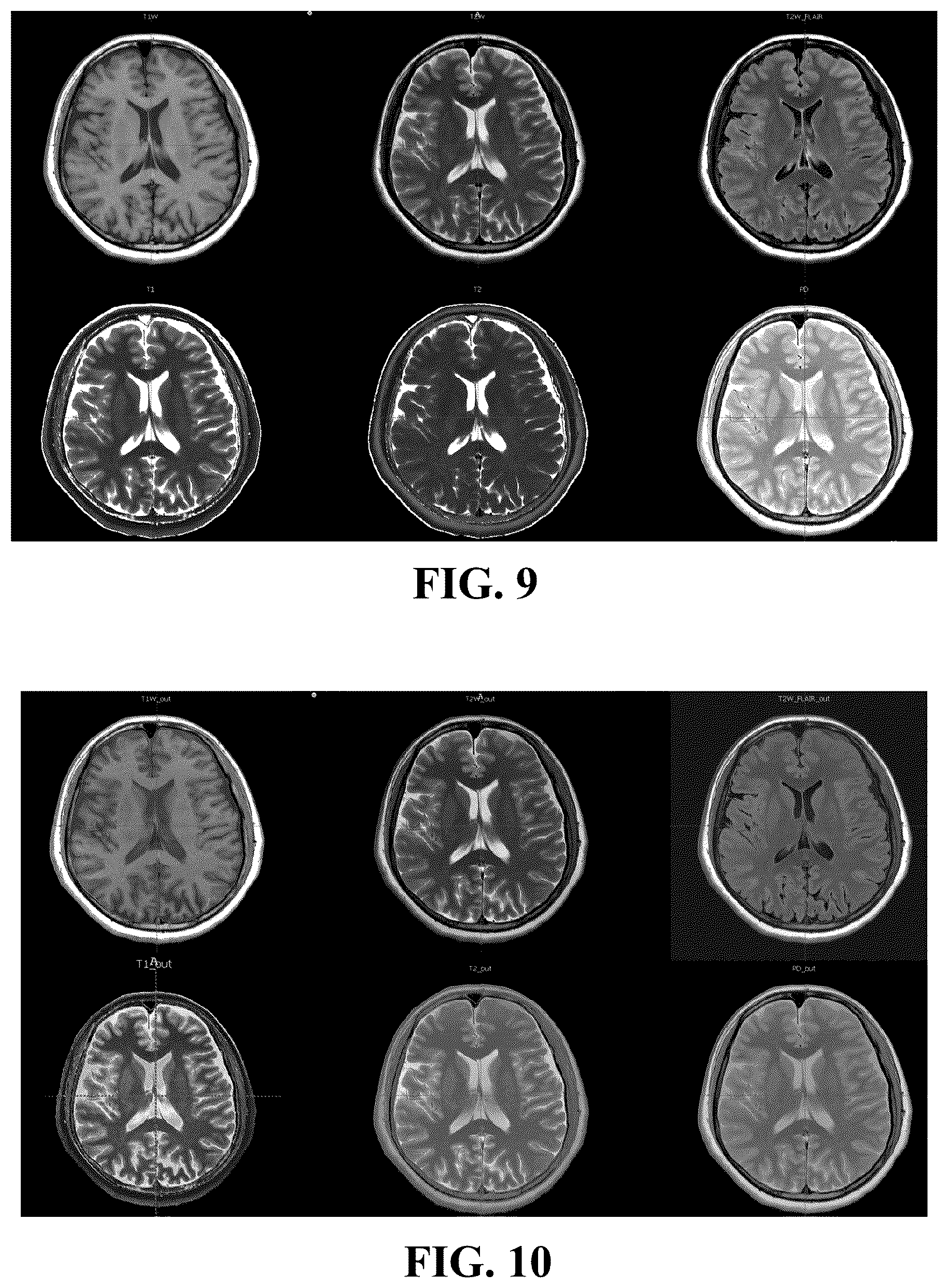 Patent US12322159 Figure 6 – Medical image acquisition apparatus and method