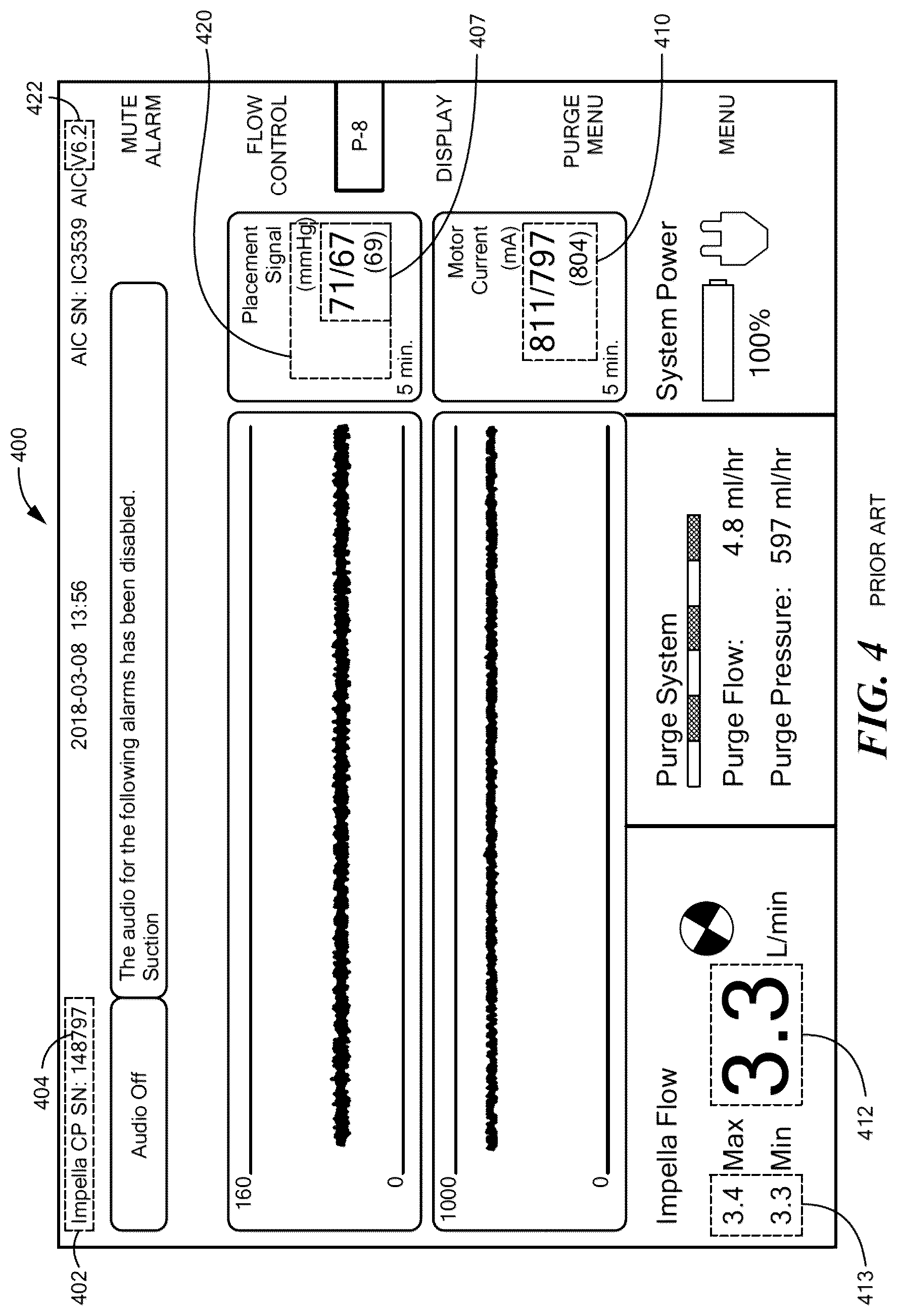 Patent US12322197 Figure 4 – Intelligent image segmentation prior to optical character recognition (OCR)