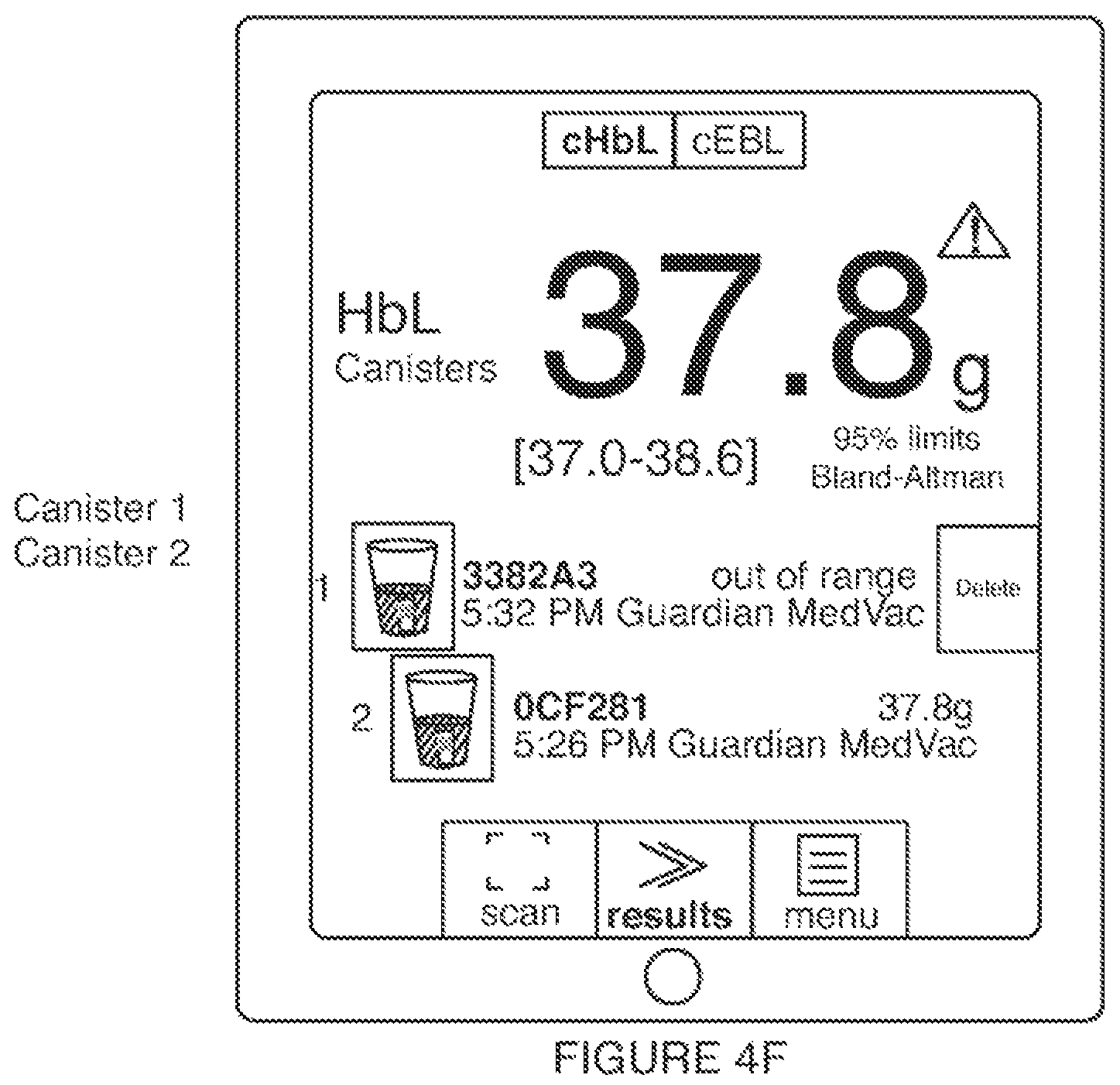 Patent US12322275 Figure 11 – Method for estimating a quantity of a blood component in a fluid receiver and corresponding error