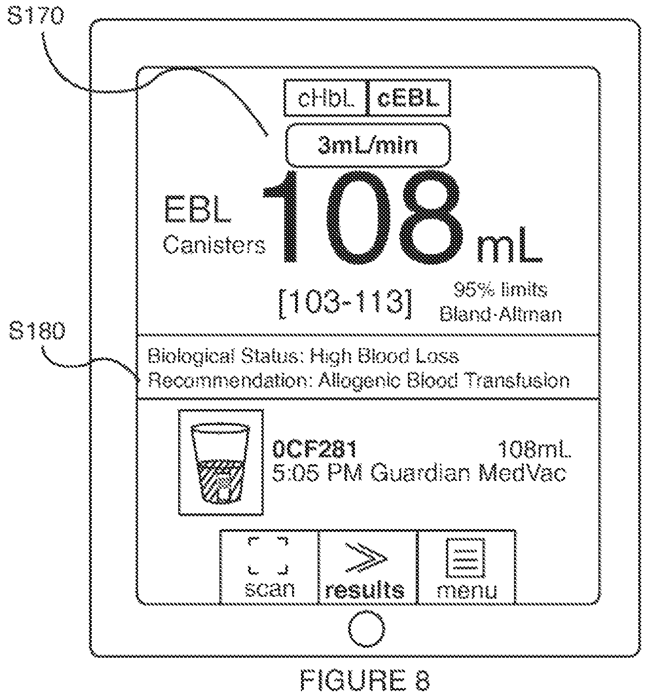 Patent US12322275 Figure 15 – Method for estimating a quantity of a blood component in a fluid receiver and corresponding error