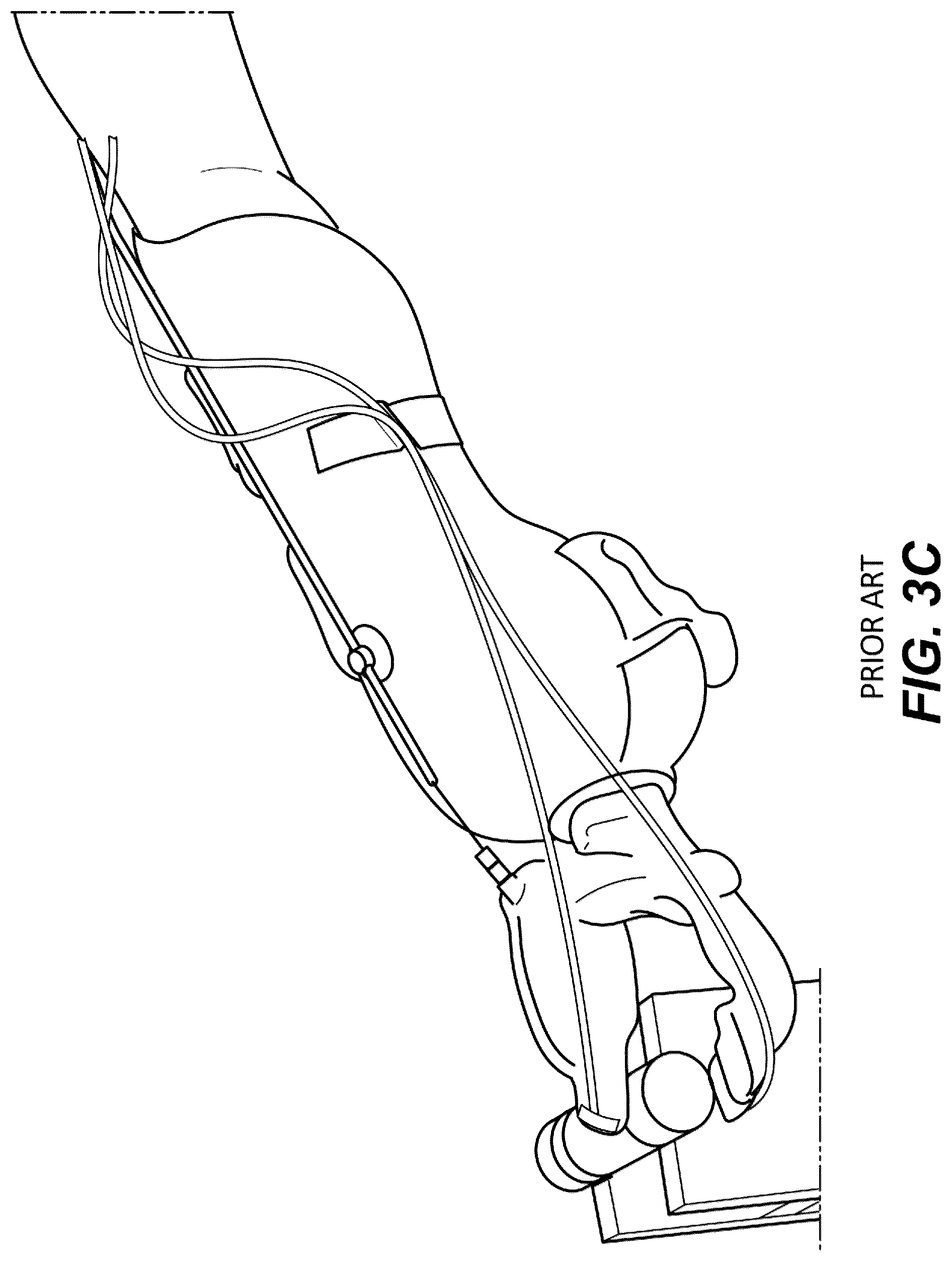 Patent US12322298 Figure 6 – Prosthesis simulator devices and methods