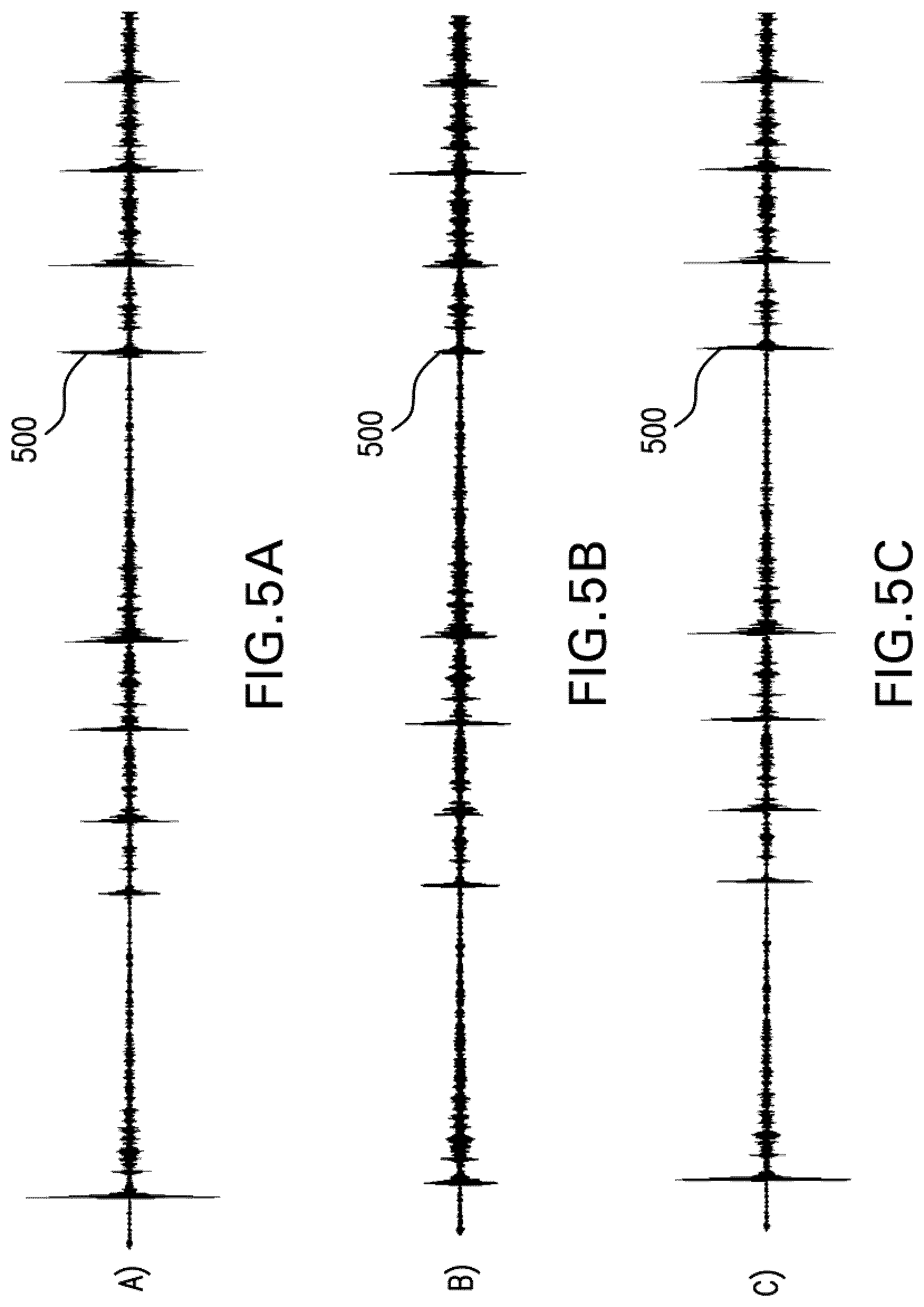 Patent US12322405 Figure 5 – Methods and devices for detecting an attack in a sound signal to be coded and for coding the detected attack