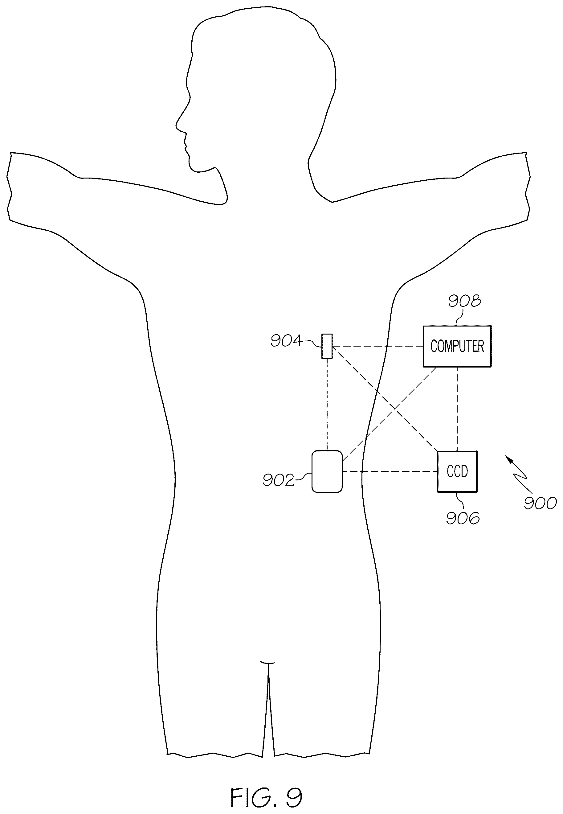 Patent US12322492 Figure 9 – Personalized event detection