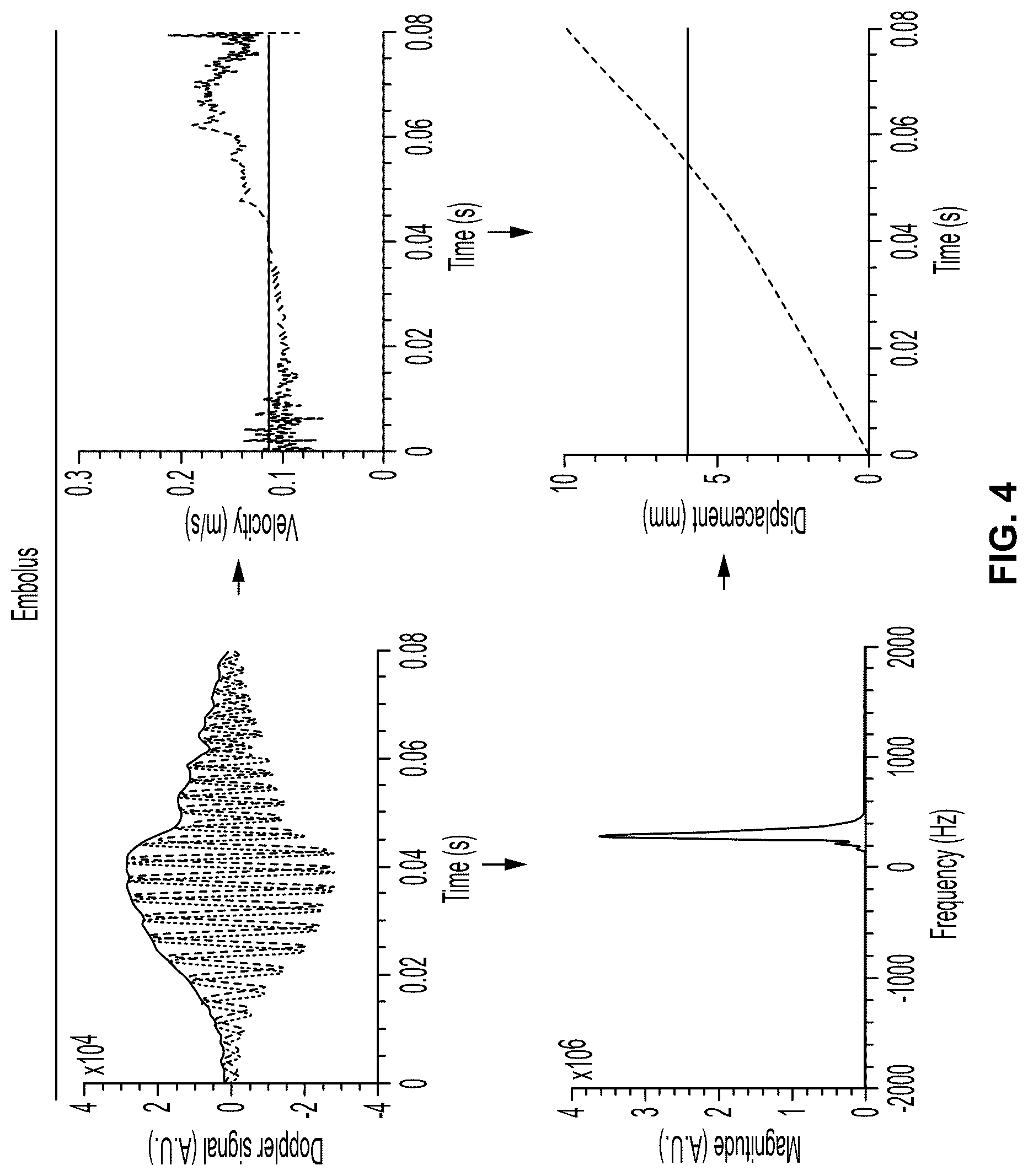 Patent US12322497 Figure 3 – Emboli detection methods to identify mechanisms of brain injury in susceptible adults and children