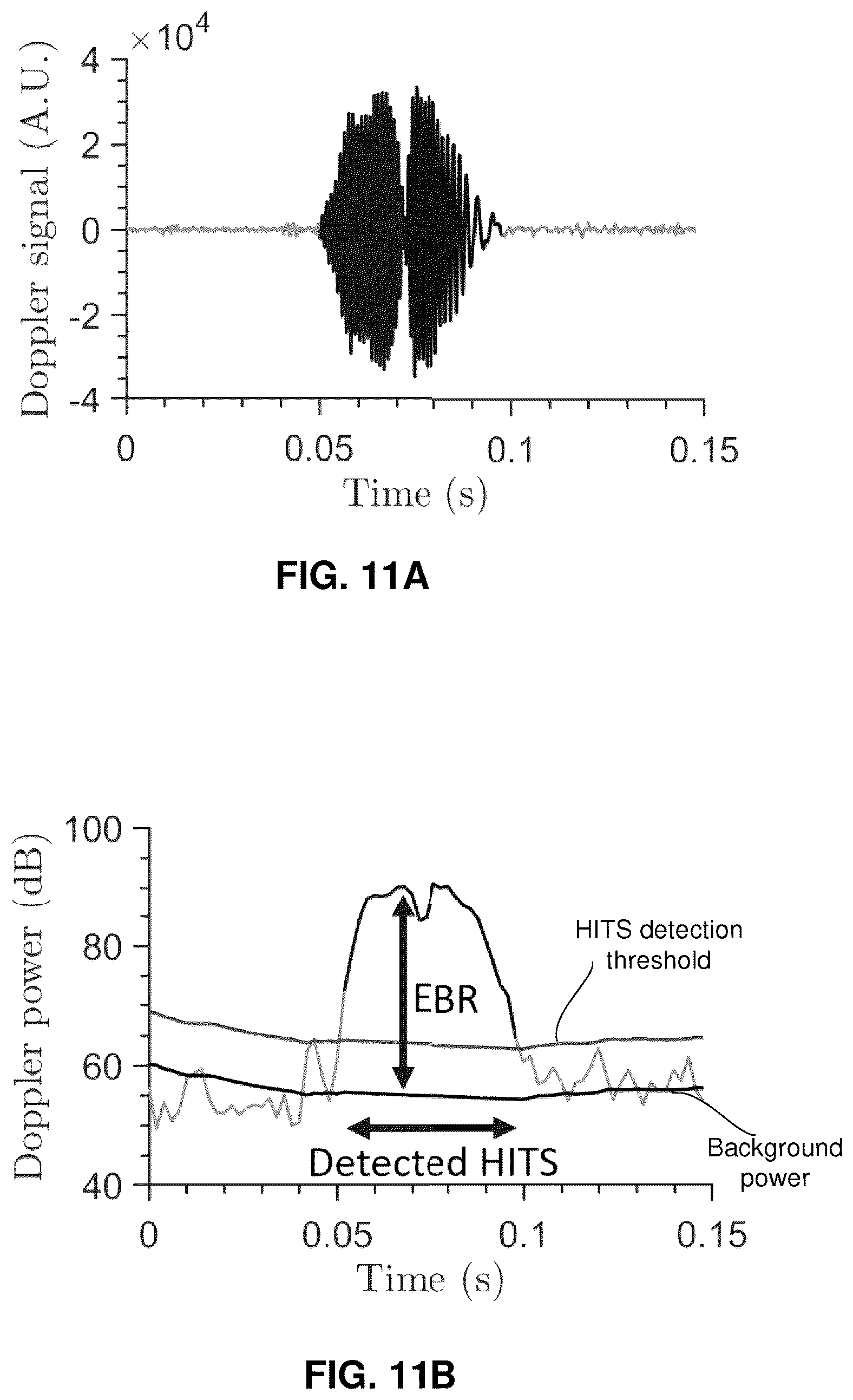 Patent US12322497 Figure 10 – Emboli detection methods to identify mechanisms of brain injury in susceptible adults and children
