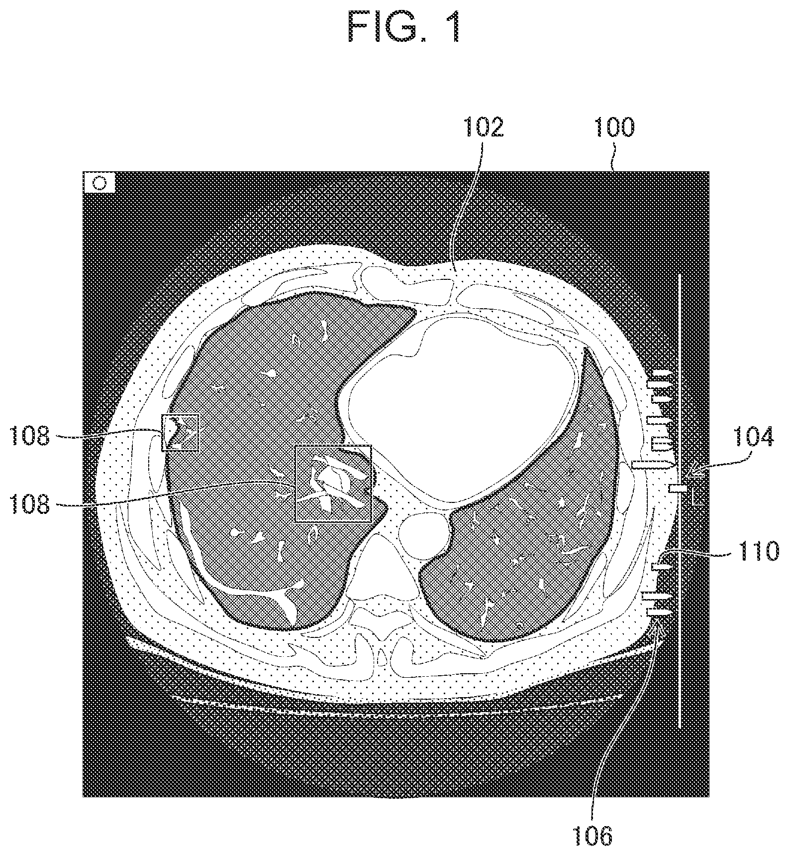 Patent US12322498 Figure 1 – Image processing apparatus, image display system, image processing method, and program for displaying information associated with region of interest of medical image