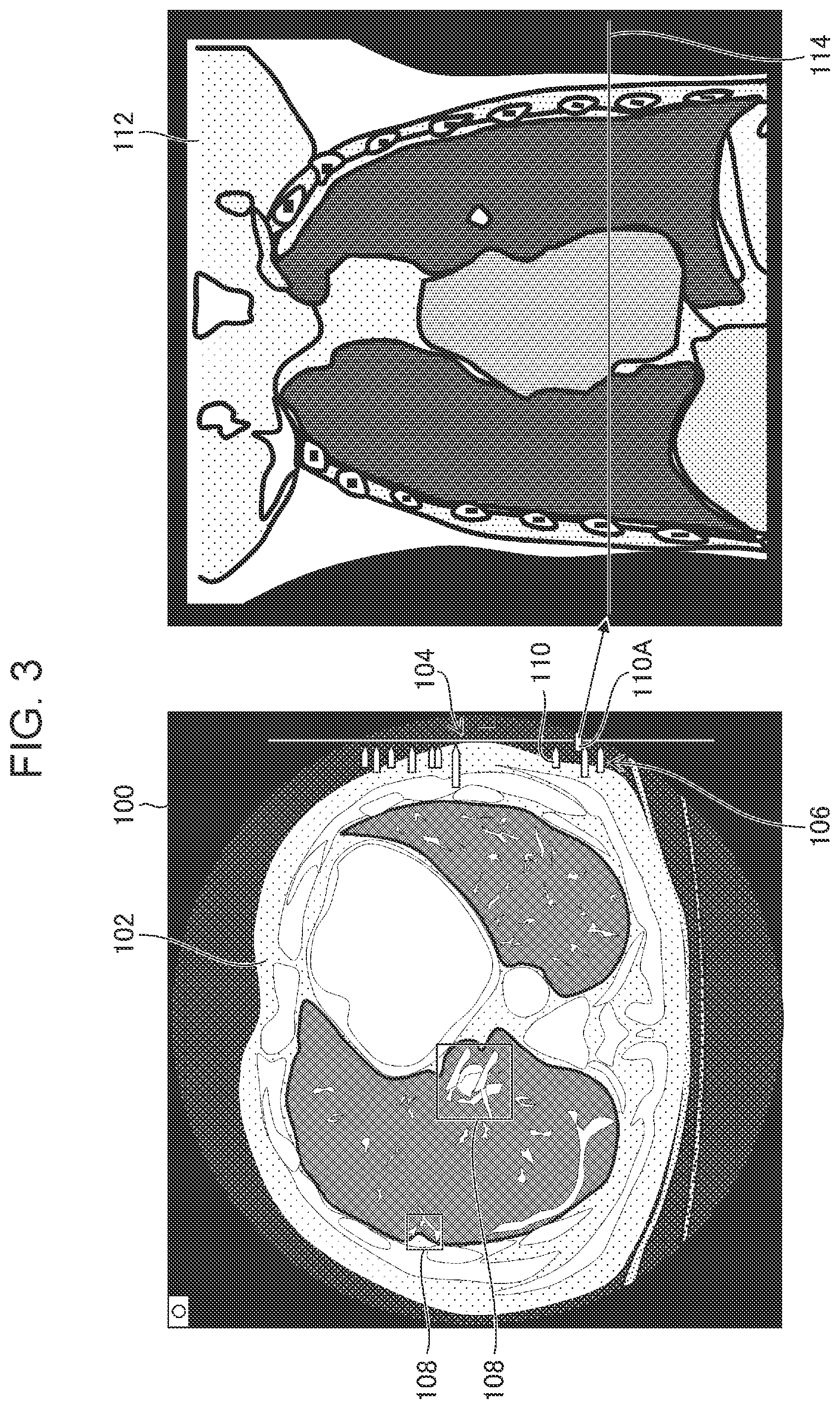 Patent US12322498 Figure 3 – Image processing apparatus, image display system, image processing method, and program for displaying information associated with region of interest of medical image