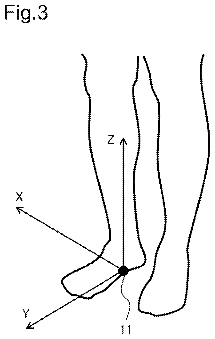 Patent US12322506 Figure 3 – Discrimination device, discrimination method, and program recording medium