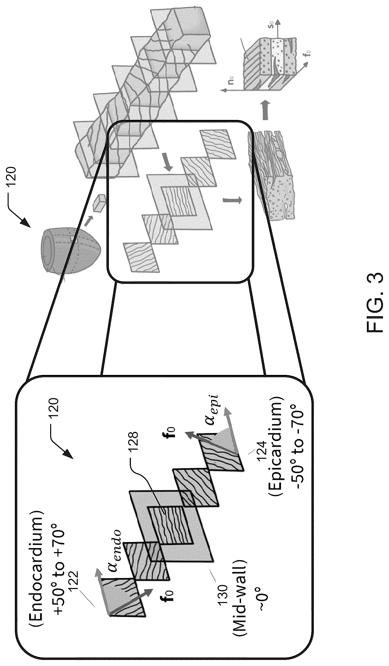 Patent US12322510 Figure 3 – Systems and methods for providing active contraction properties of the myocardium using limited clinical metrics