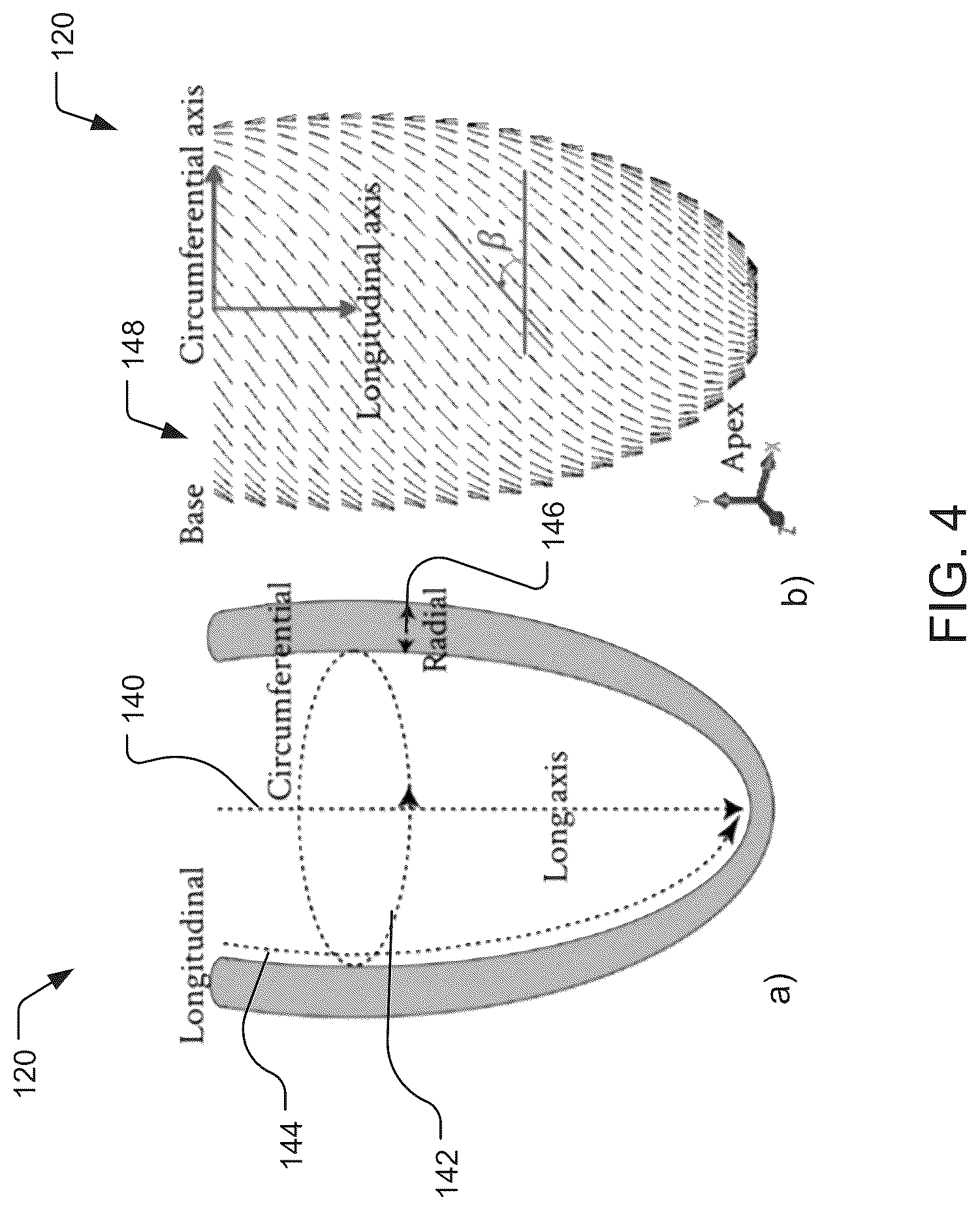 Patent US12322510 Figure 4 – Systems and methods for providing active contraction properties of the myocardium using limited clinical metrics