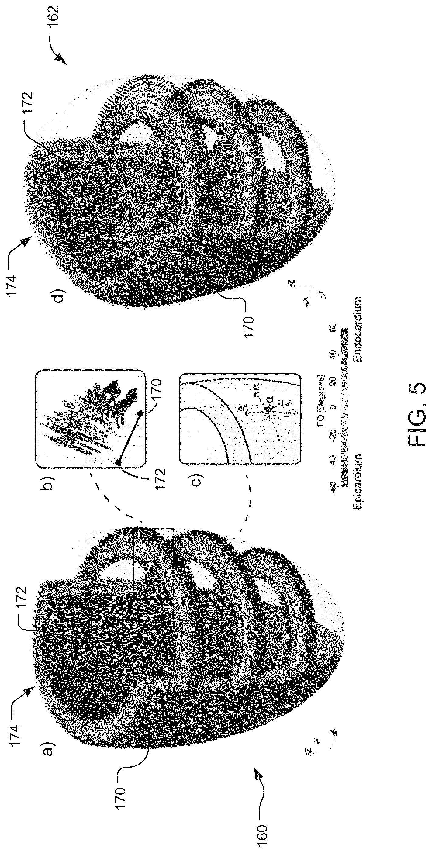 Patent US12322510 Figure 5 – Systems and methods for providing active contraction properties of the myocardium using limited clinical metrics