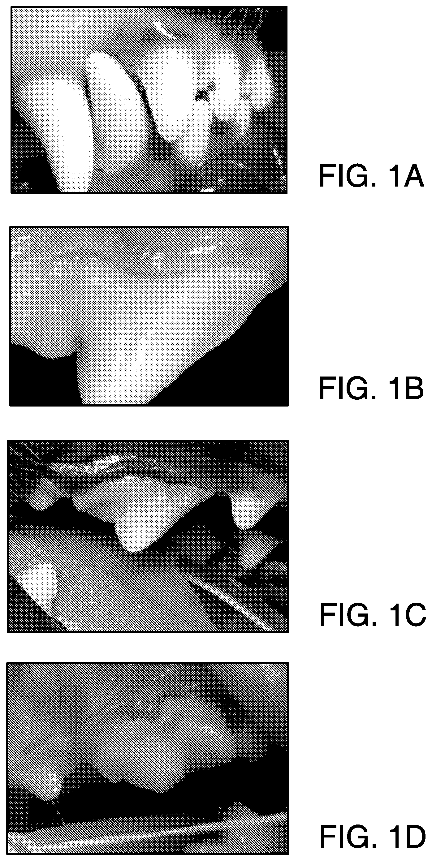 Patent US12322513 — Method or system for diagnosing periodontal disease — Figure 1