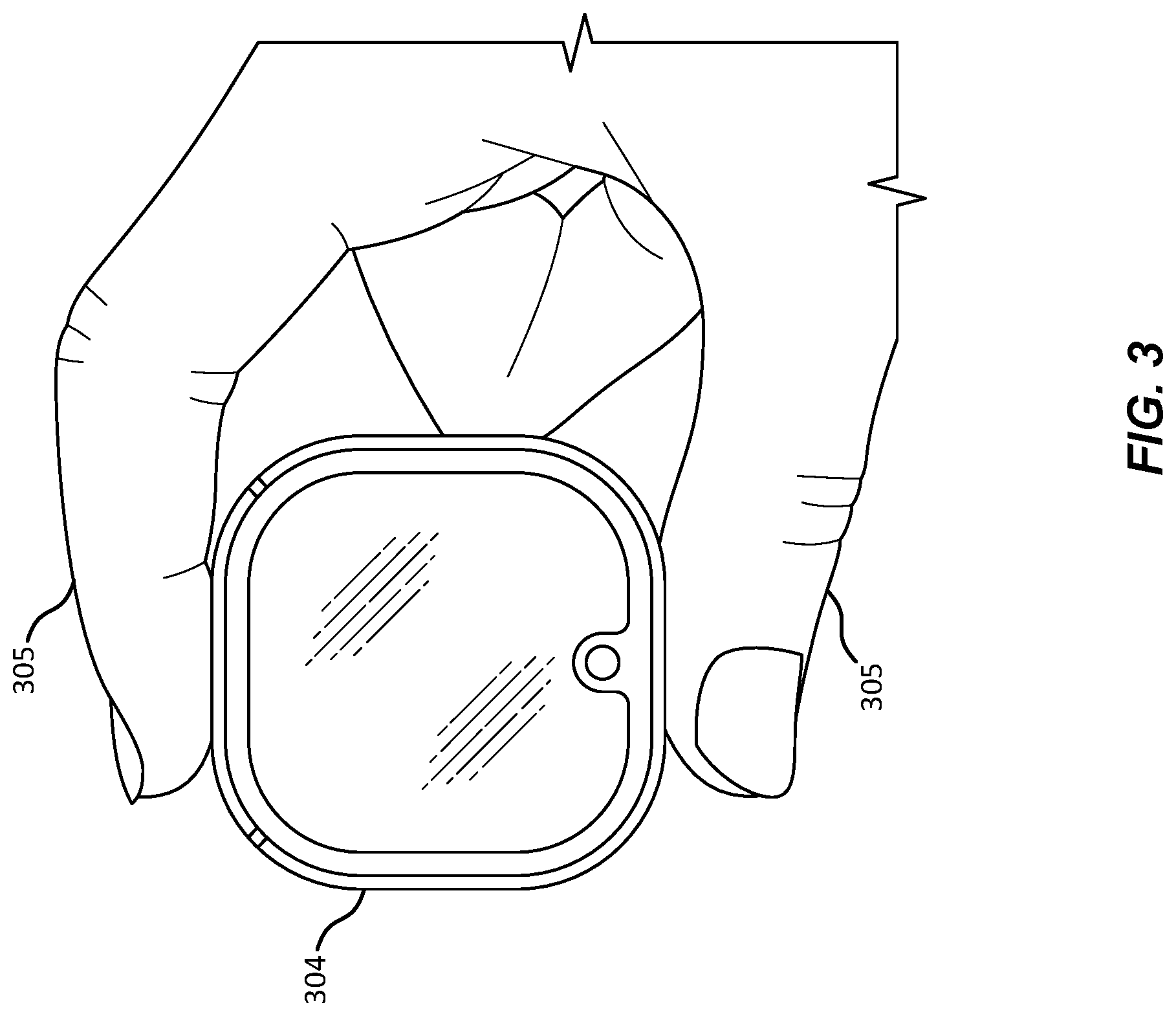 Patent US12322857 Figure 3 – Antenna architecture for a wearable device and related devices and methods