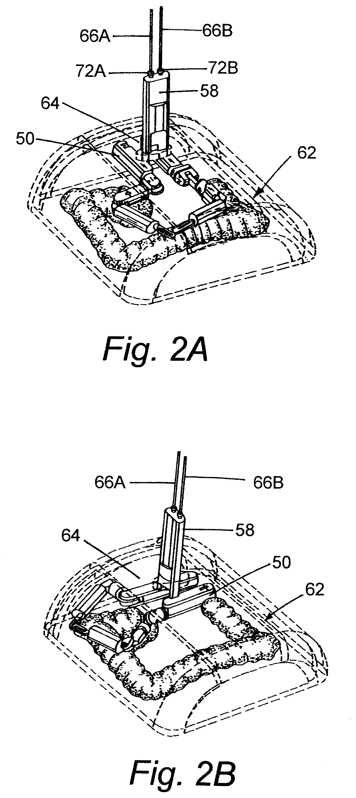 Patent US12323289 Figure 2 – Robotic surgical devices, systems, and related methods