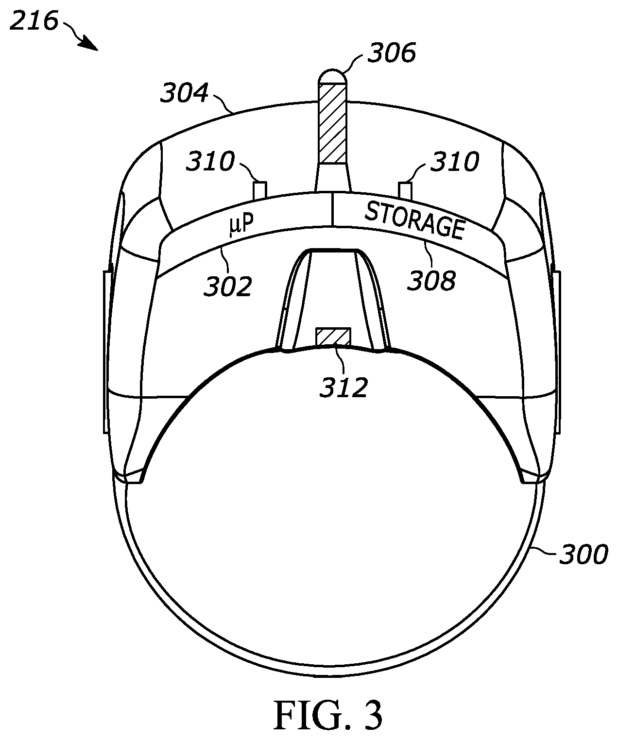 Patent US12323679 Figure 3 – Streaming of composite alpha-blended ar/mr video to others