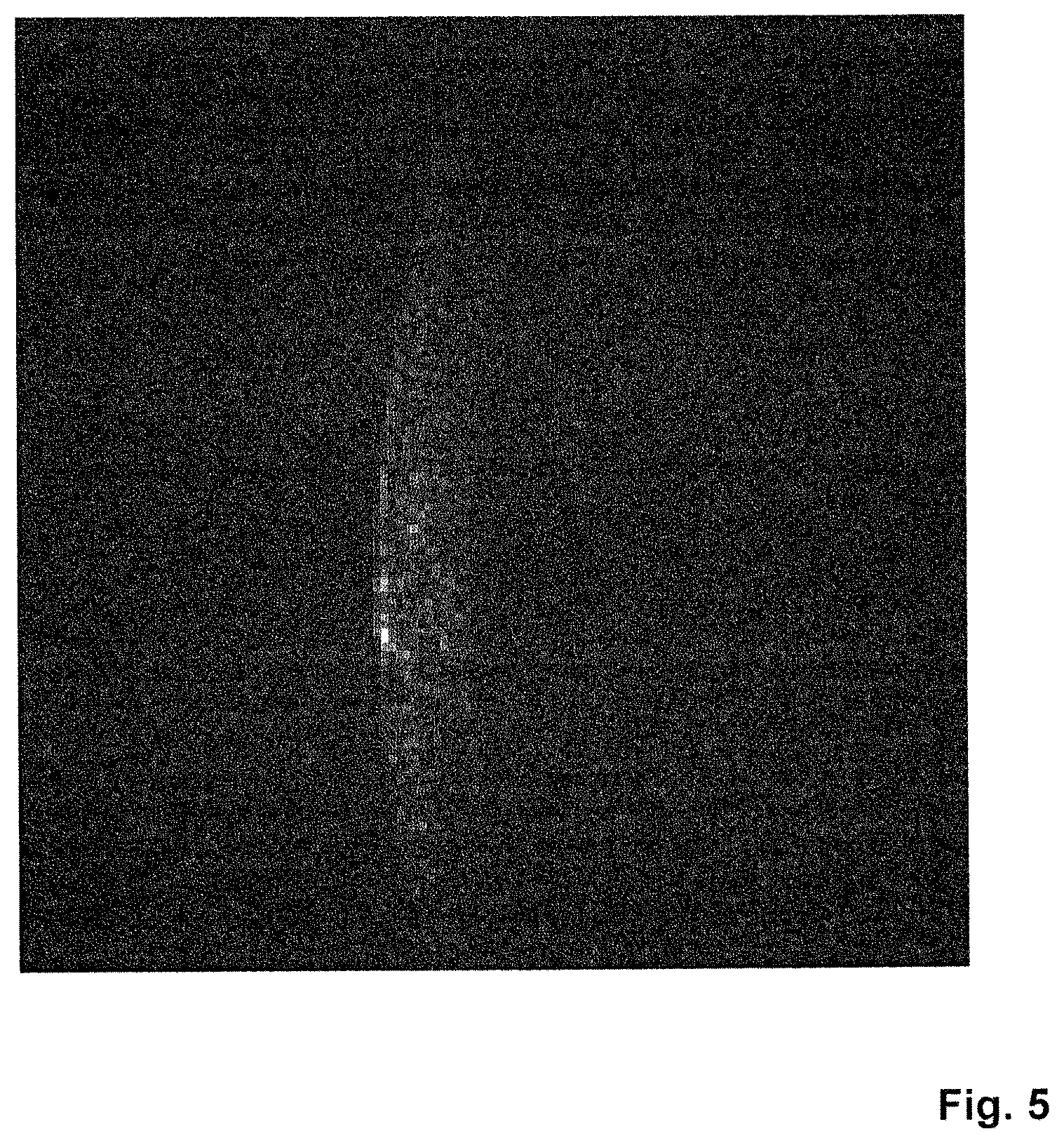 Patent US12323712 Figure 3 – Image exposure techniques for ophthalmic microscope devices