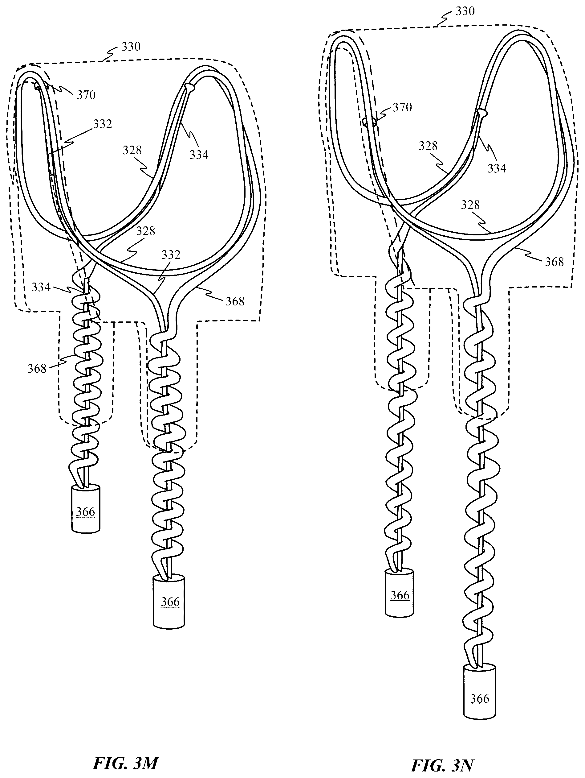 Patent US12323755 Figure 12 – Headphones