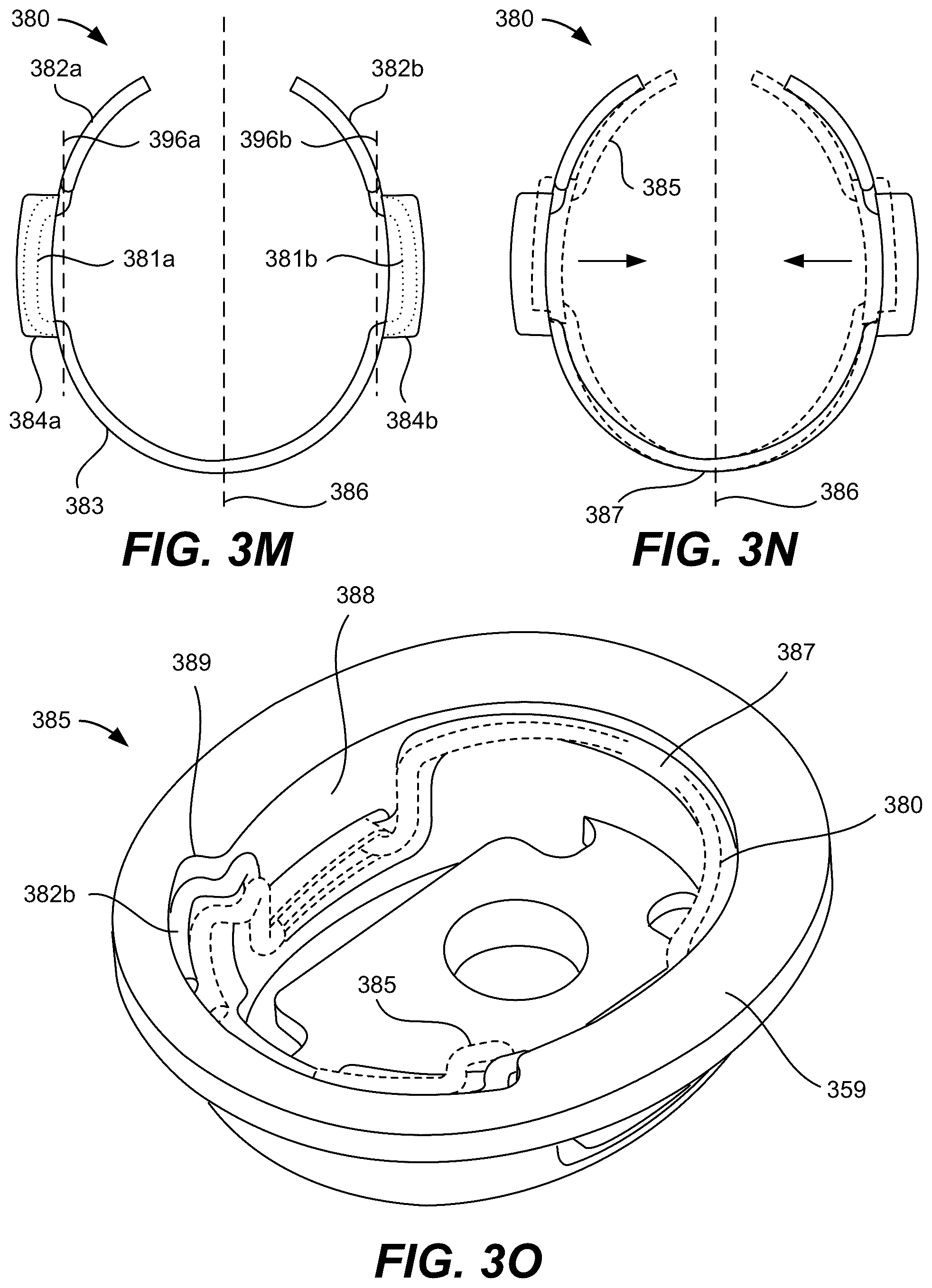 Patent US12323757 Figure 10 – Bistable hinge for portable wireless listening device case