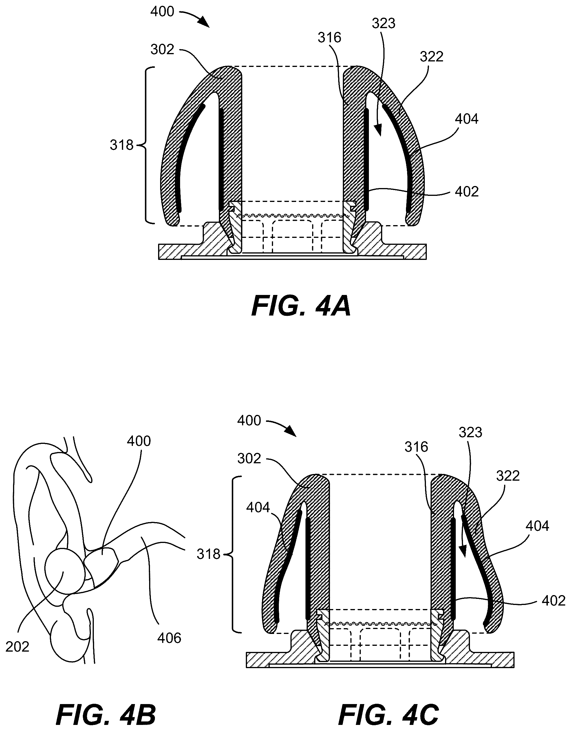 Patent US12323757 Figure 12 – Bistable hinge for portable wireless listening device case