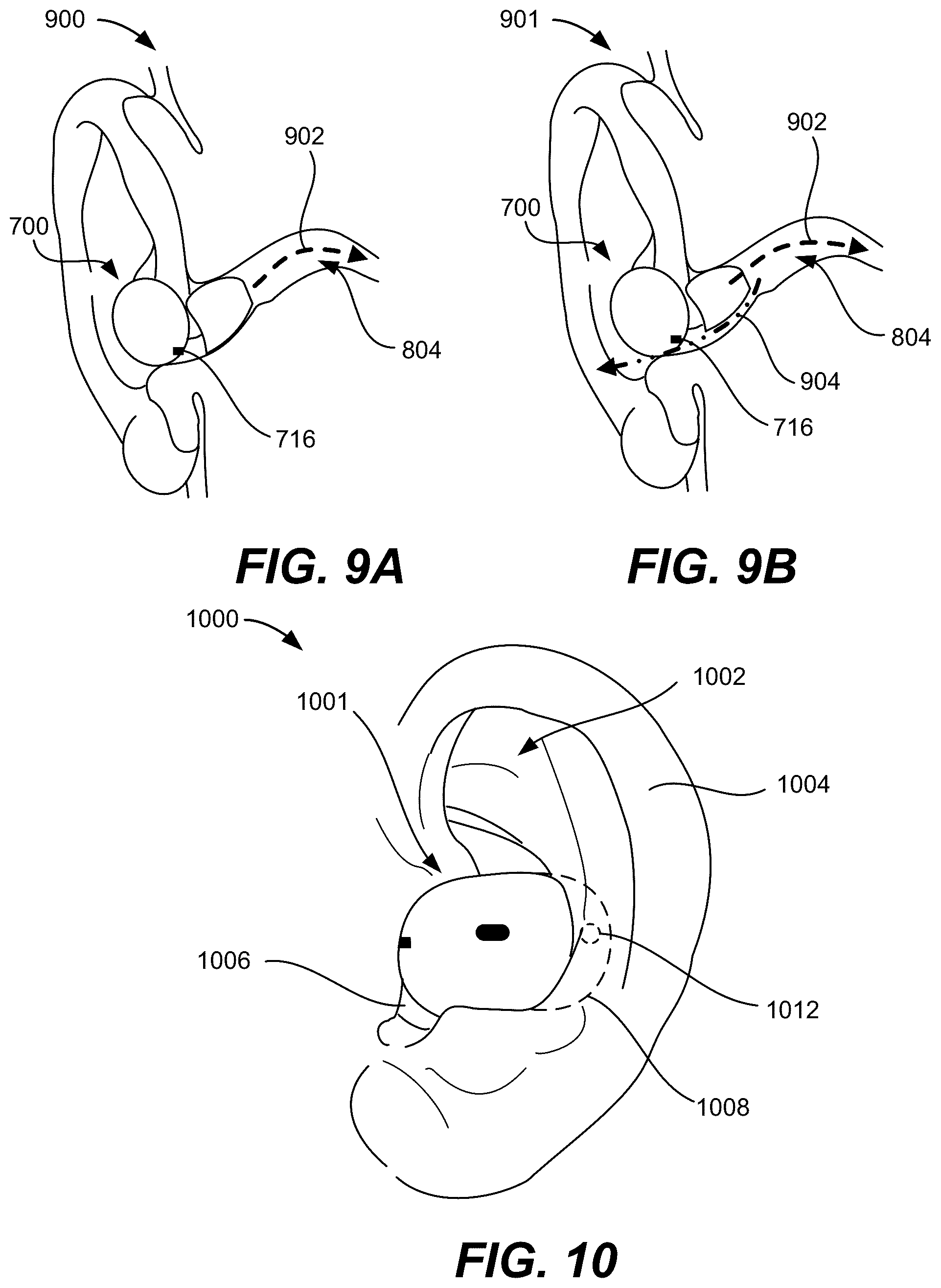 Patent US12323757 Figure 18 – Bistable hinge for portable wireless listening device case
