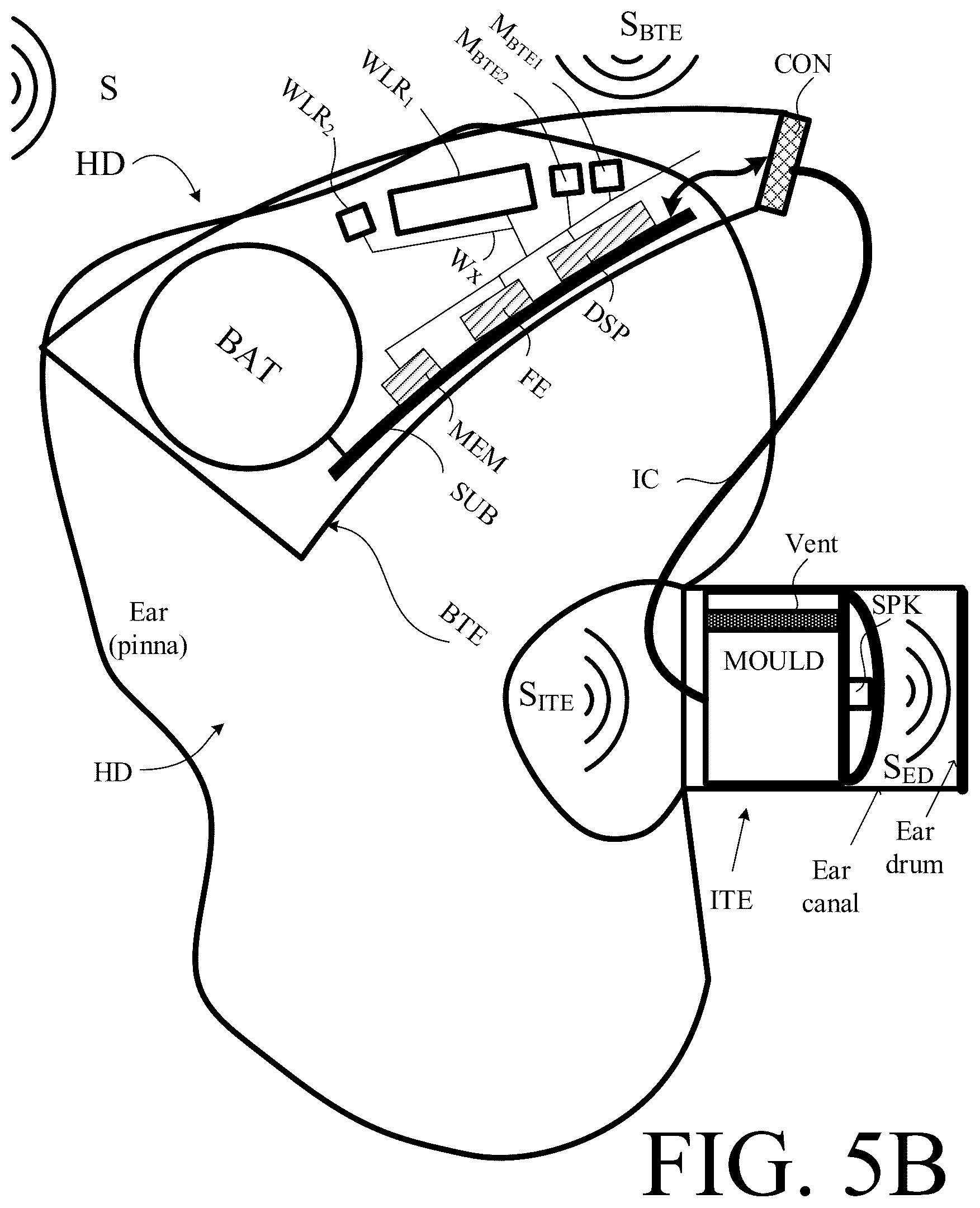 Patent US12323766 Figure 10 – Binaural hearing system comprising frequency transition