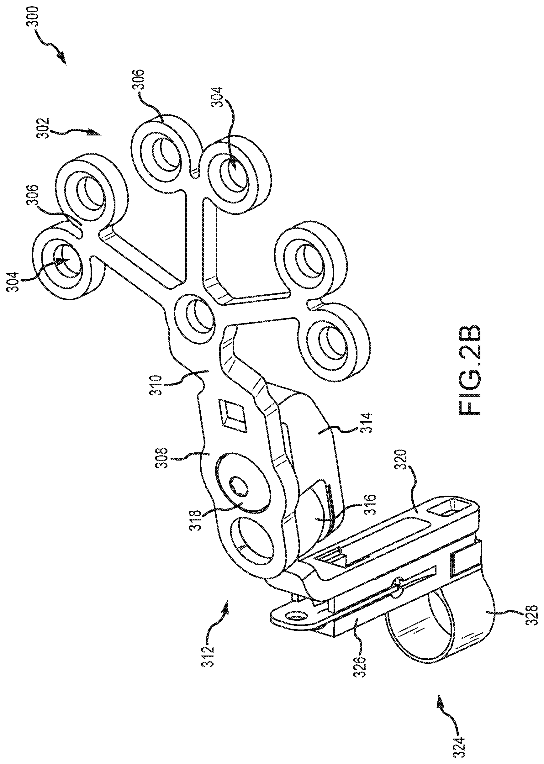 Patent US12323771 Figure 4 – Systems for accommodating separation of body parts in auditory prostheses