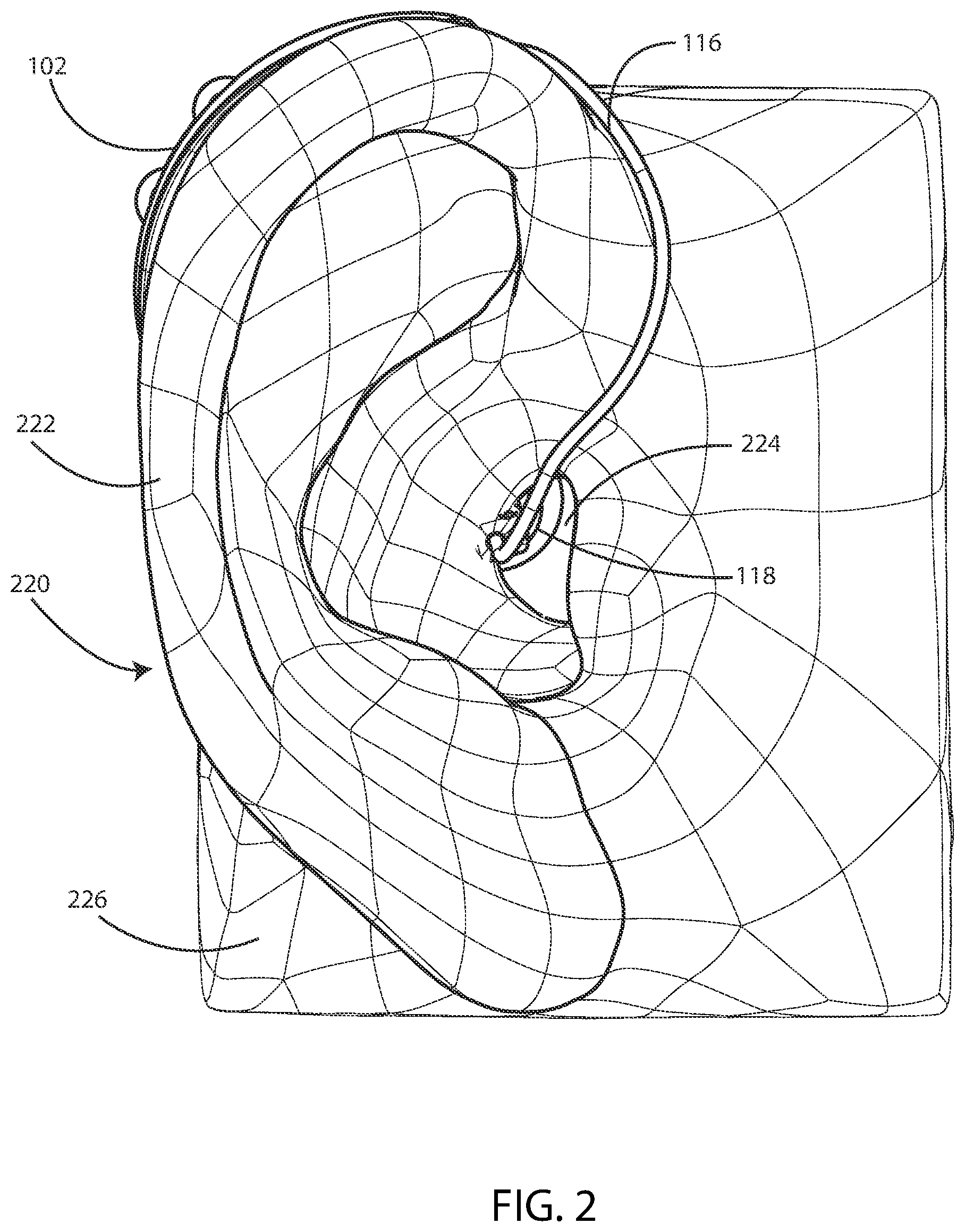 Patent US12323772 Figure 2 – Ear-wearable device with foreign material trap