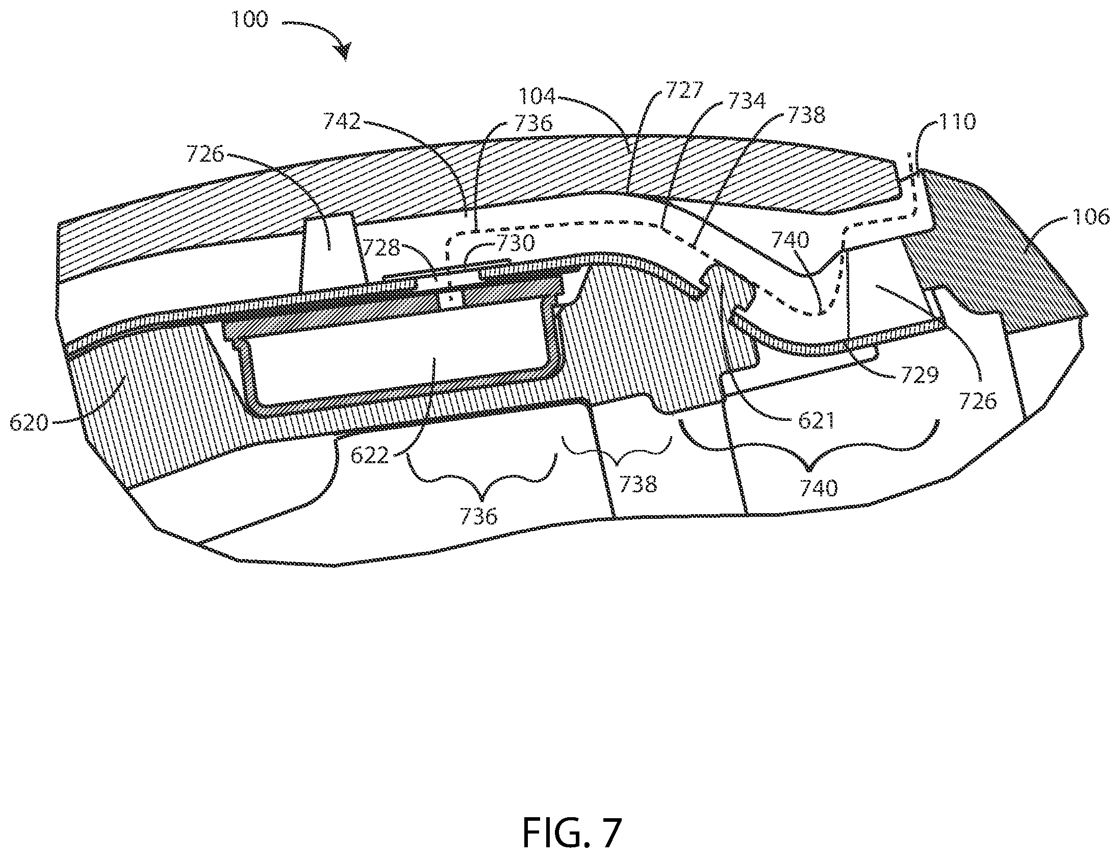 Patent US12323772 Figure 7 – Ear-wearable device with foreign material trap